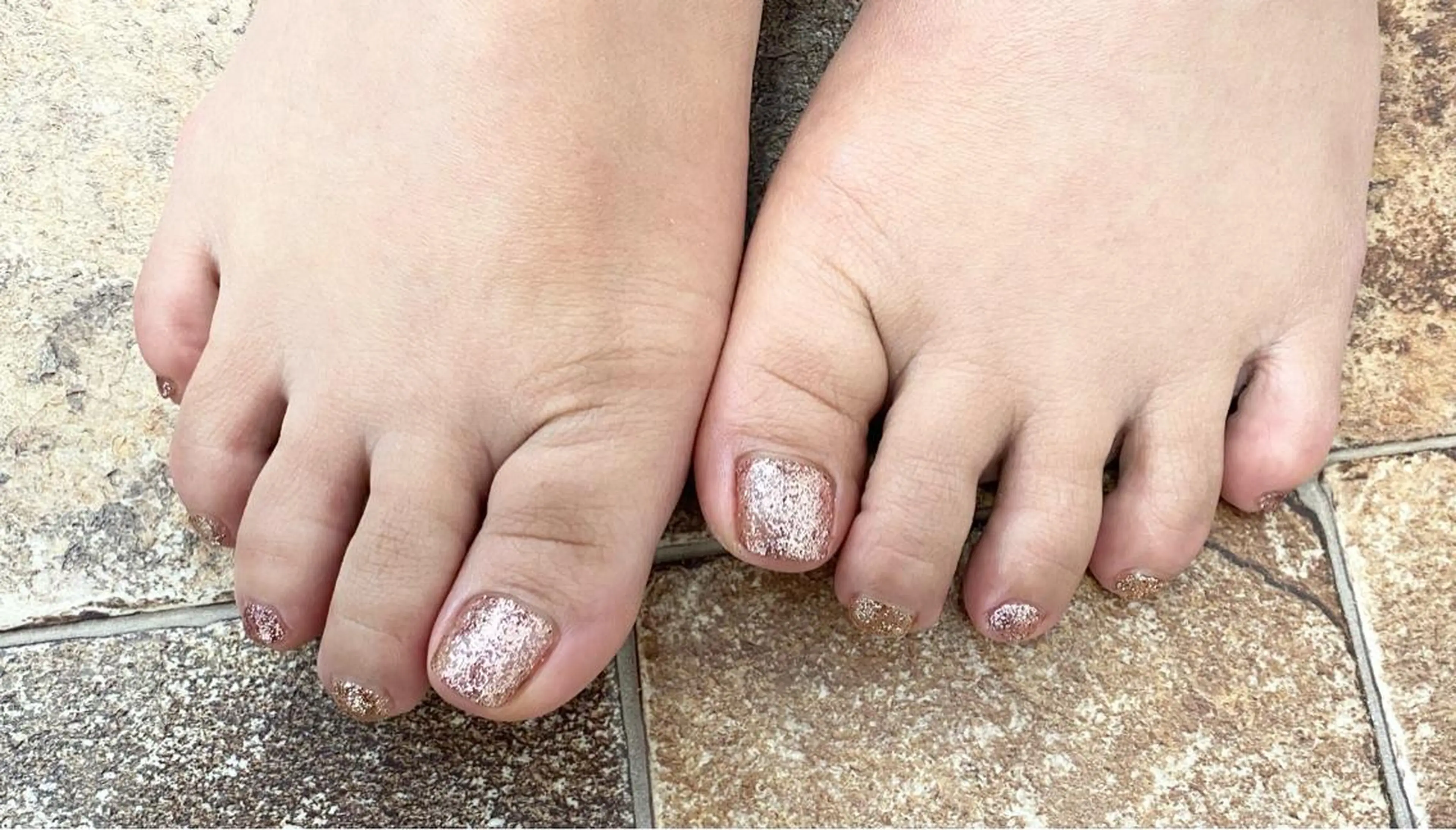 フットワンカラーの写真