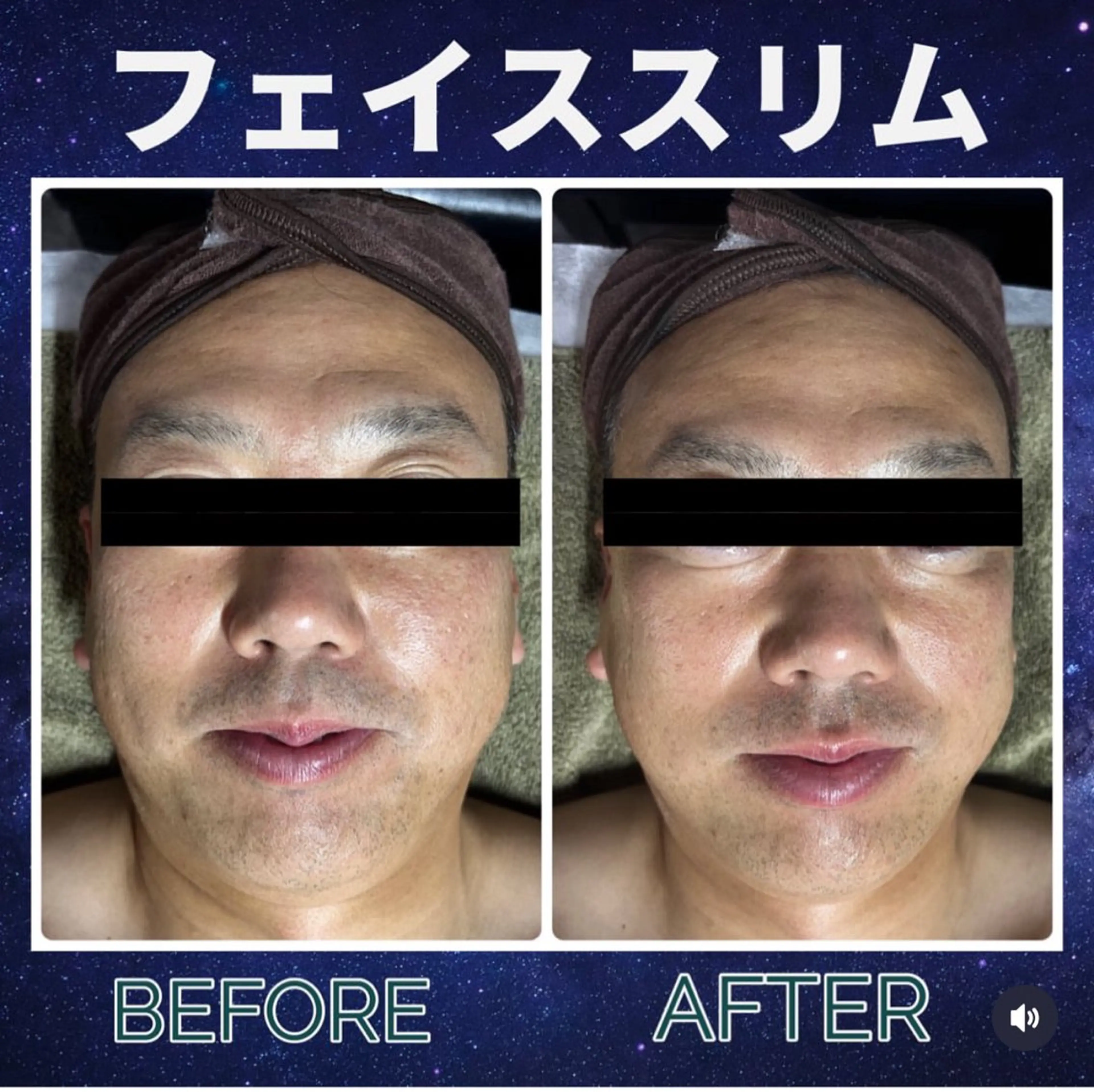 メンズ 脱毛 kozaki tomokoのエステ・リラクイメージ