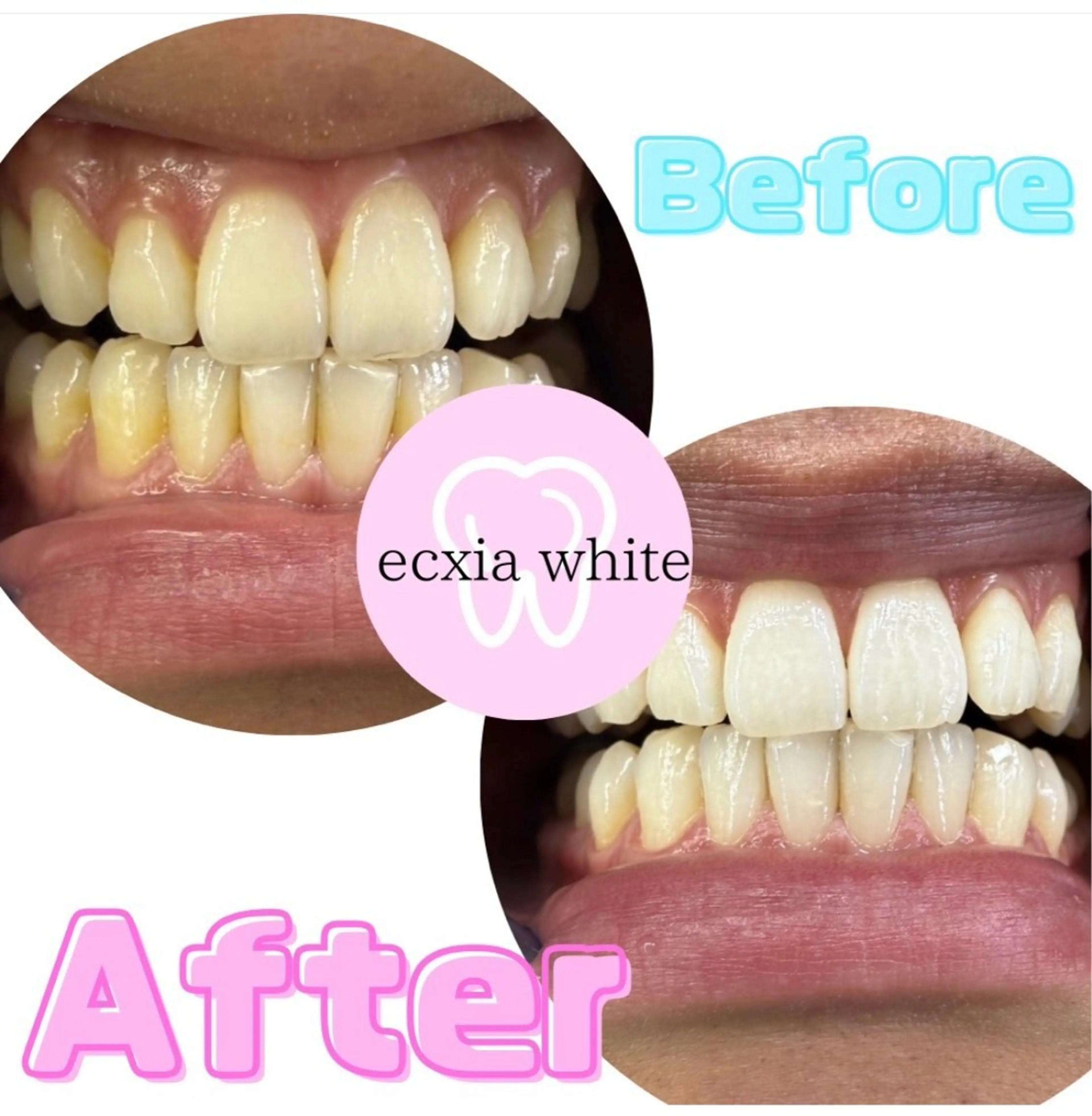 ecxia white 高田馬場所属・セルフホワイトニング エクシア 高田馬場のその他イメージ