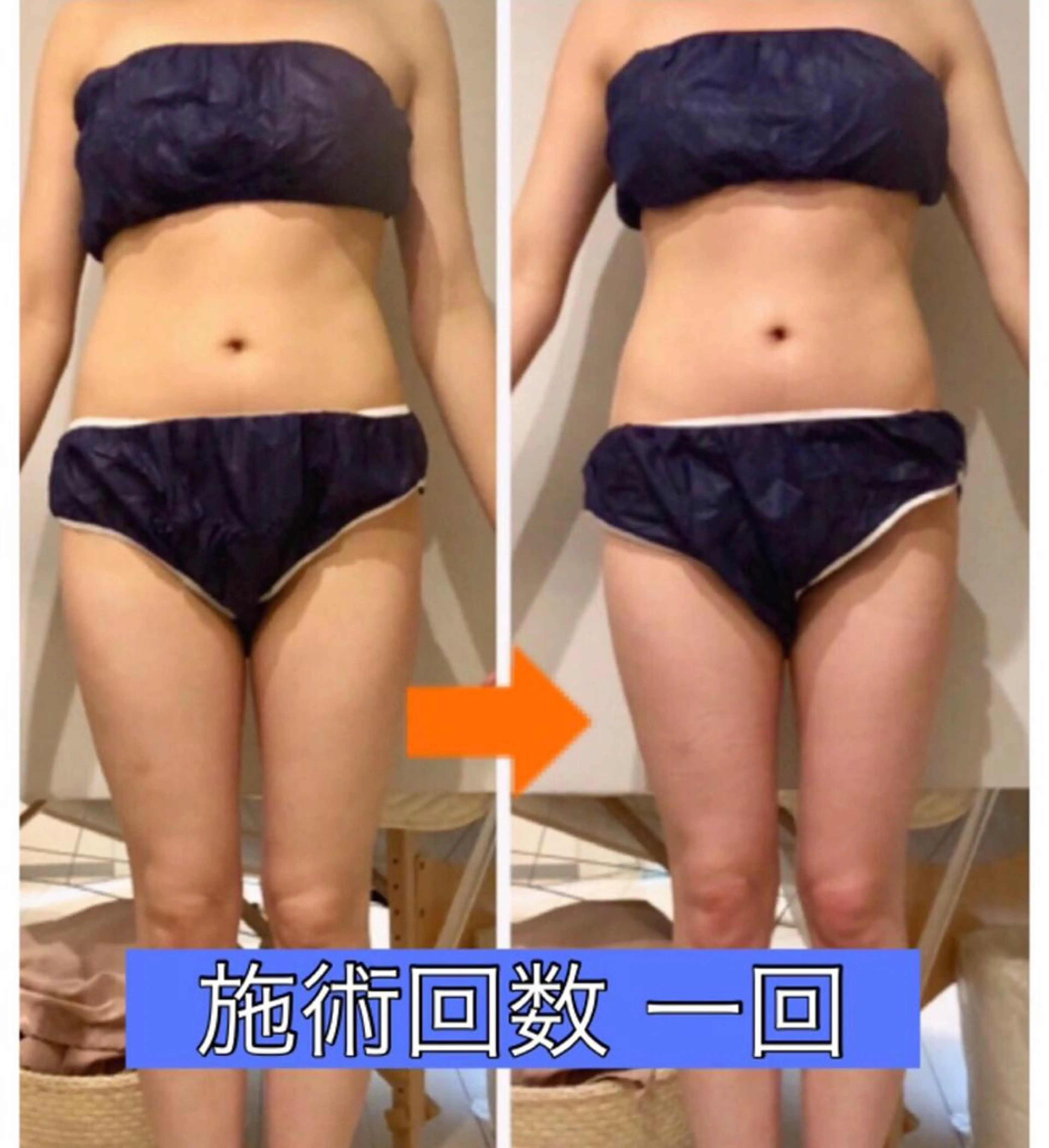 ミディアム カラー パーマ ヘアアレンジ メンズ キッズ ネイル マツエク・マツパ ‍痩身＆ボディ 結果出し🌟丹野のエステ・リラクイメージ