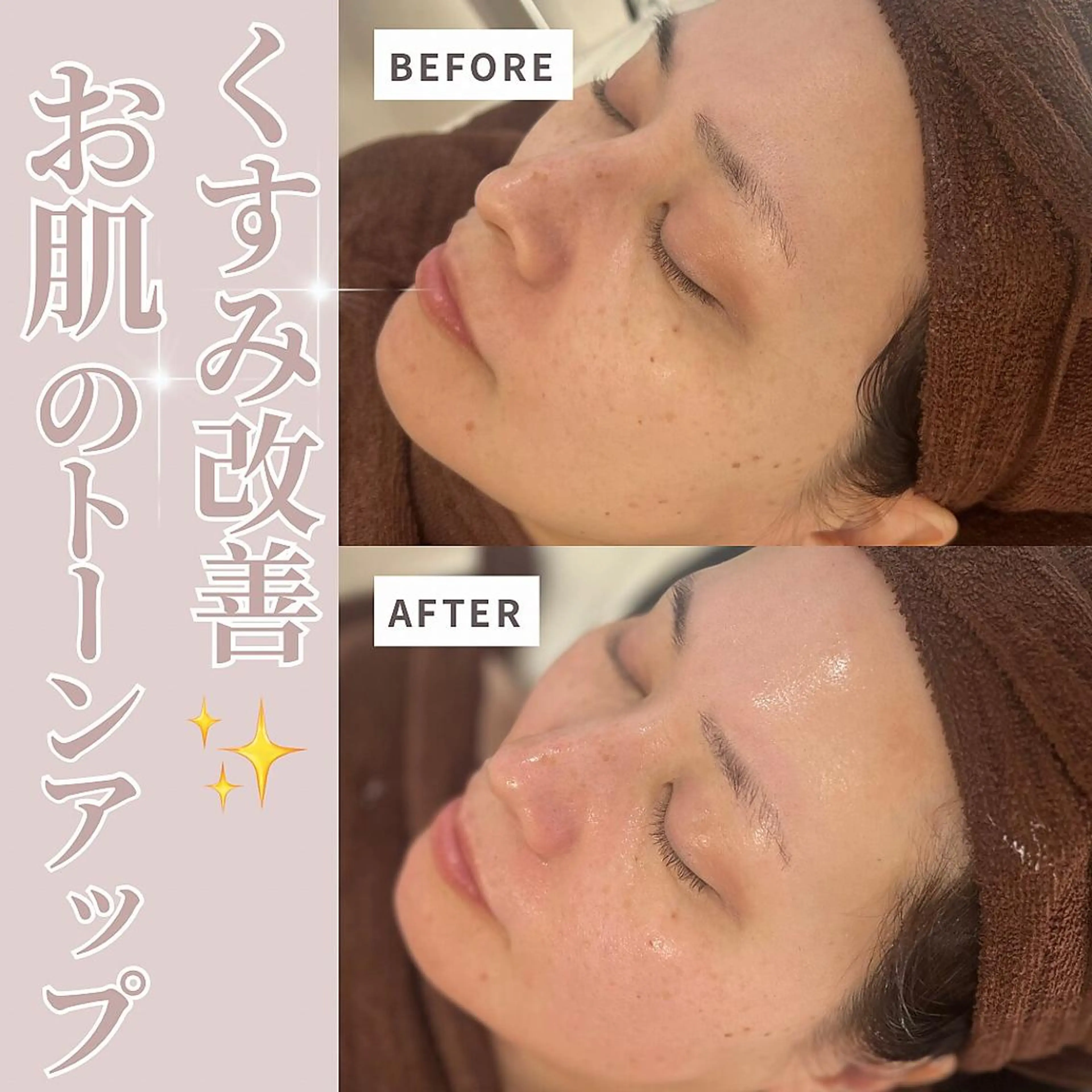 💚THE BALM 金子💚✨のエステ・リラクイメージ