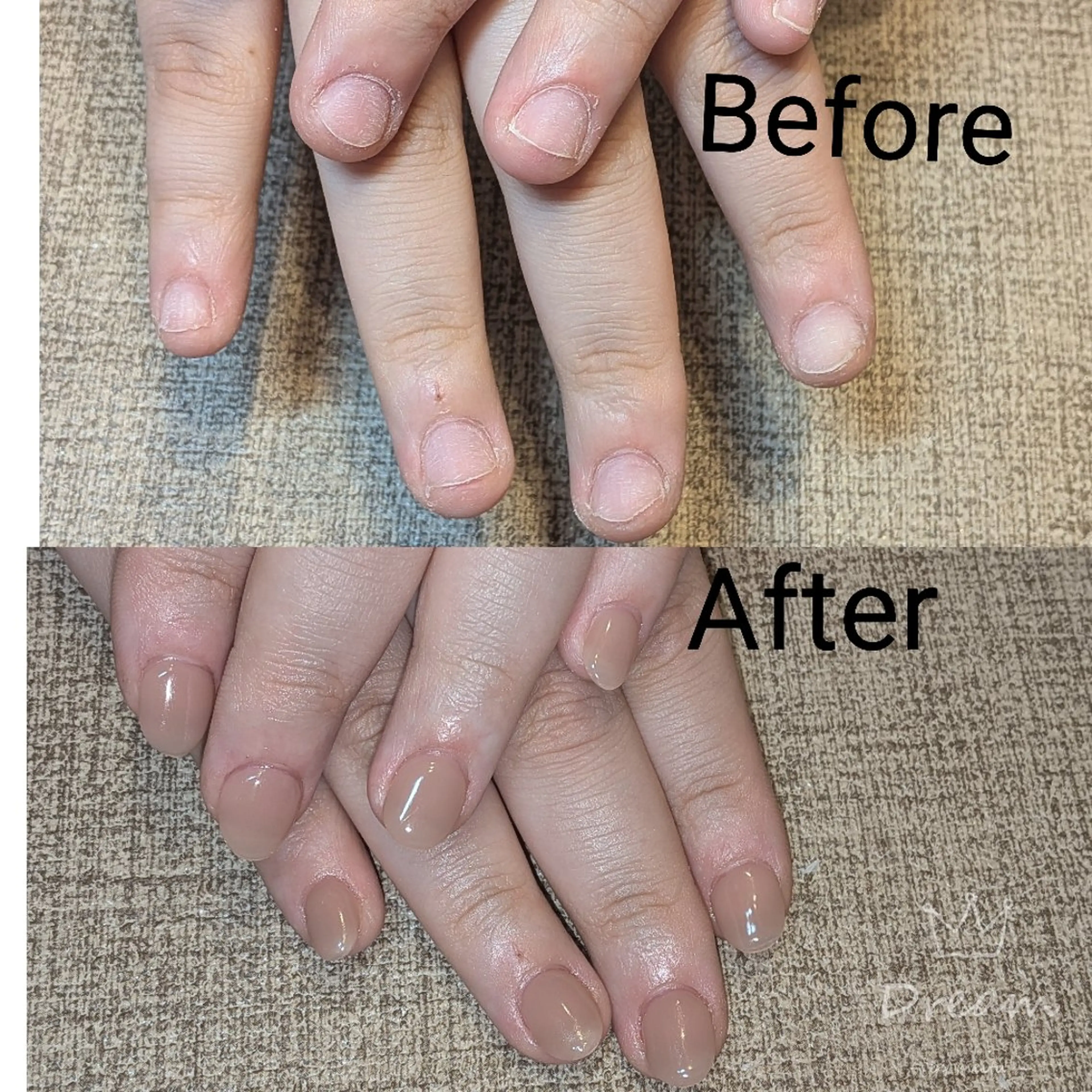 ネイル ハンドネイル ハンドケア ネイリストゆか💅 長さだし、深爪矯正のネイルデザイン