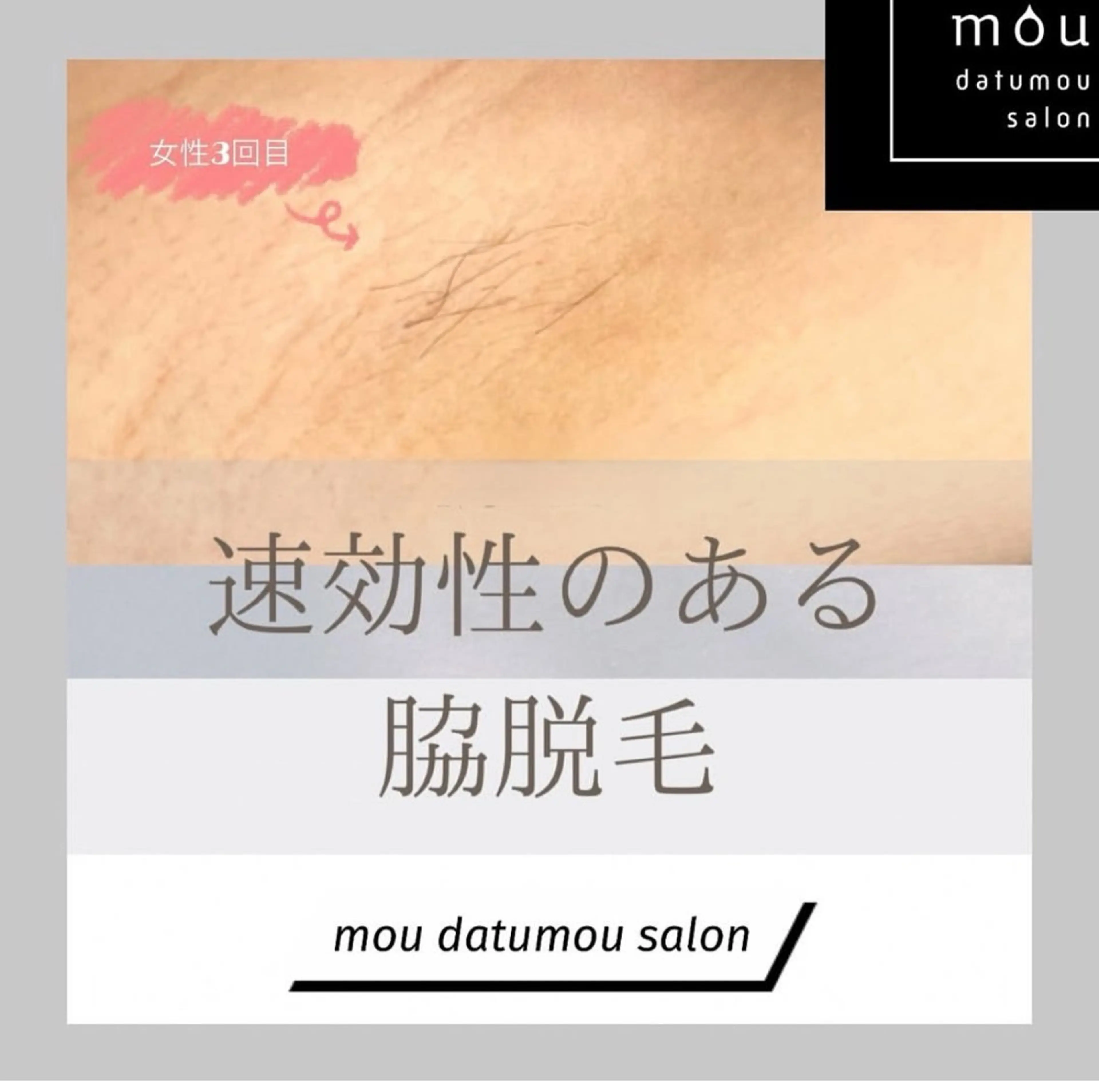 🚹限定❗️脱毛士による丁寧な脇脱毛🥼他店で抜けなかった方、初めてで分からない方、丁寧なカウンセリング込みです🤓の写真