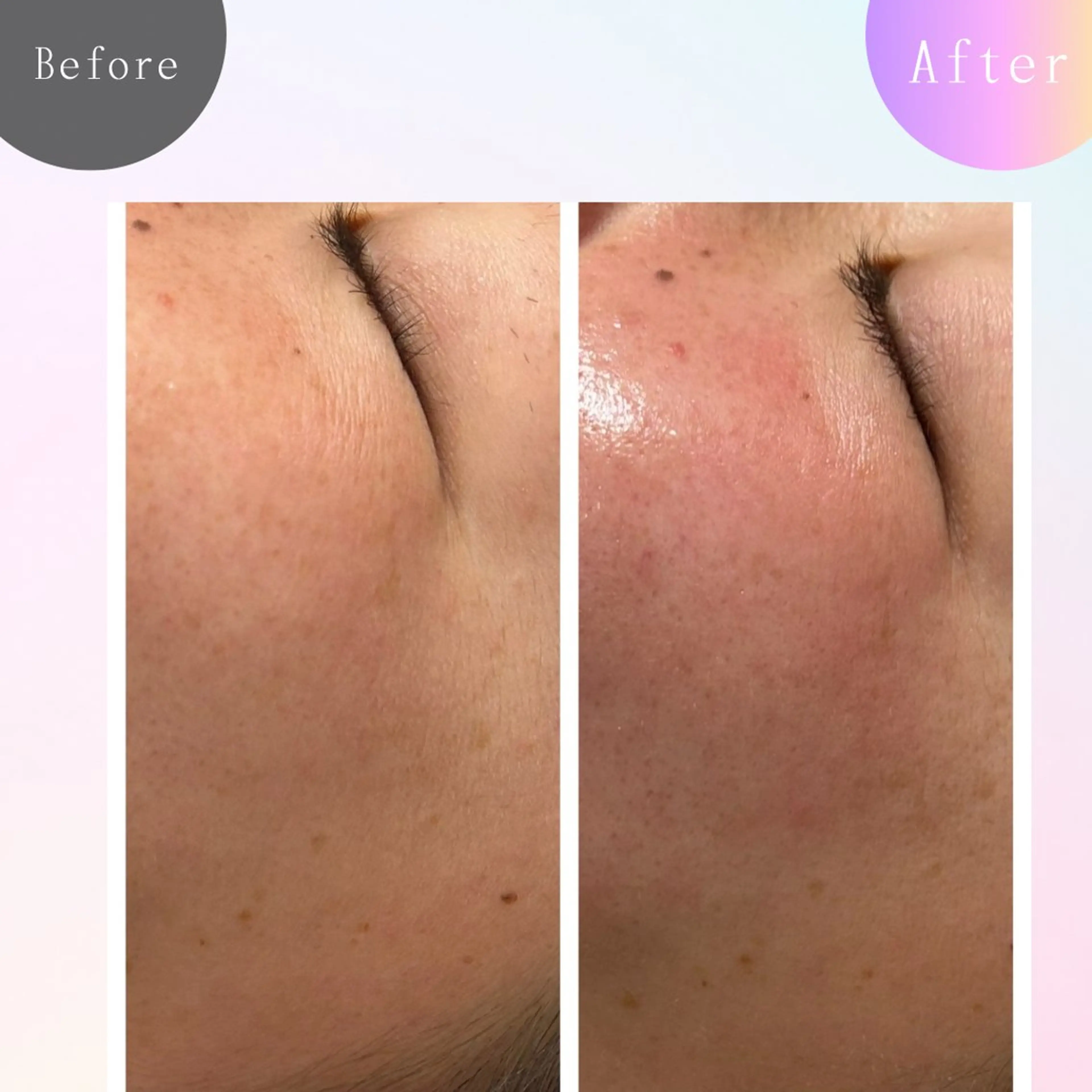 Silky ✖︎ Snow White｜エイジングケア＆美肌脱毛専門サロン所属・O 朋美のエステ・リラクイメージ