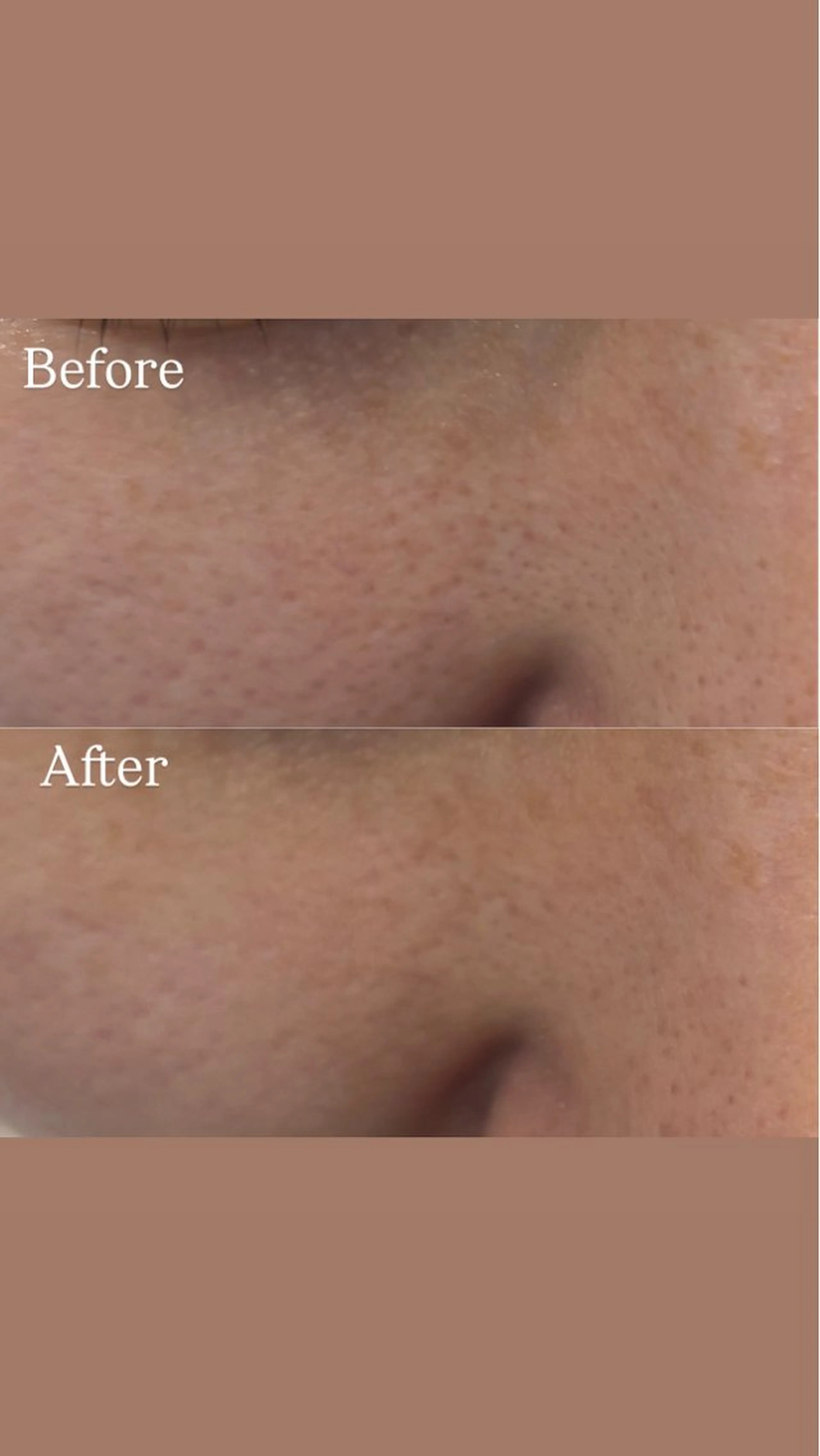 エステ Del'm豊橋所属・豊橋De'Im 安部のエステ・リラクイメージ