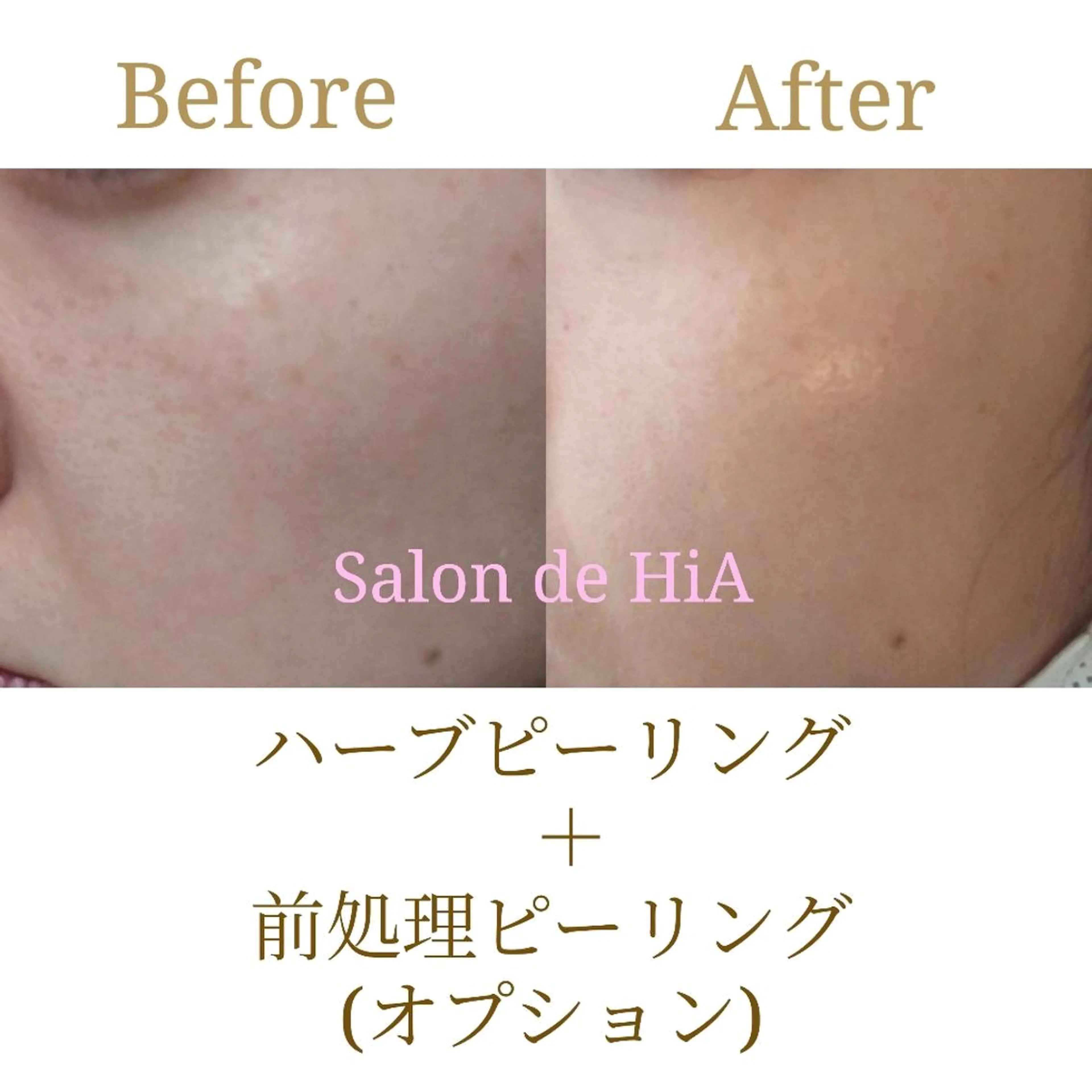 エステ Salon de  HiAのエステ・リラクイメージ