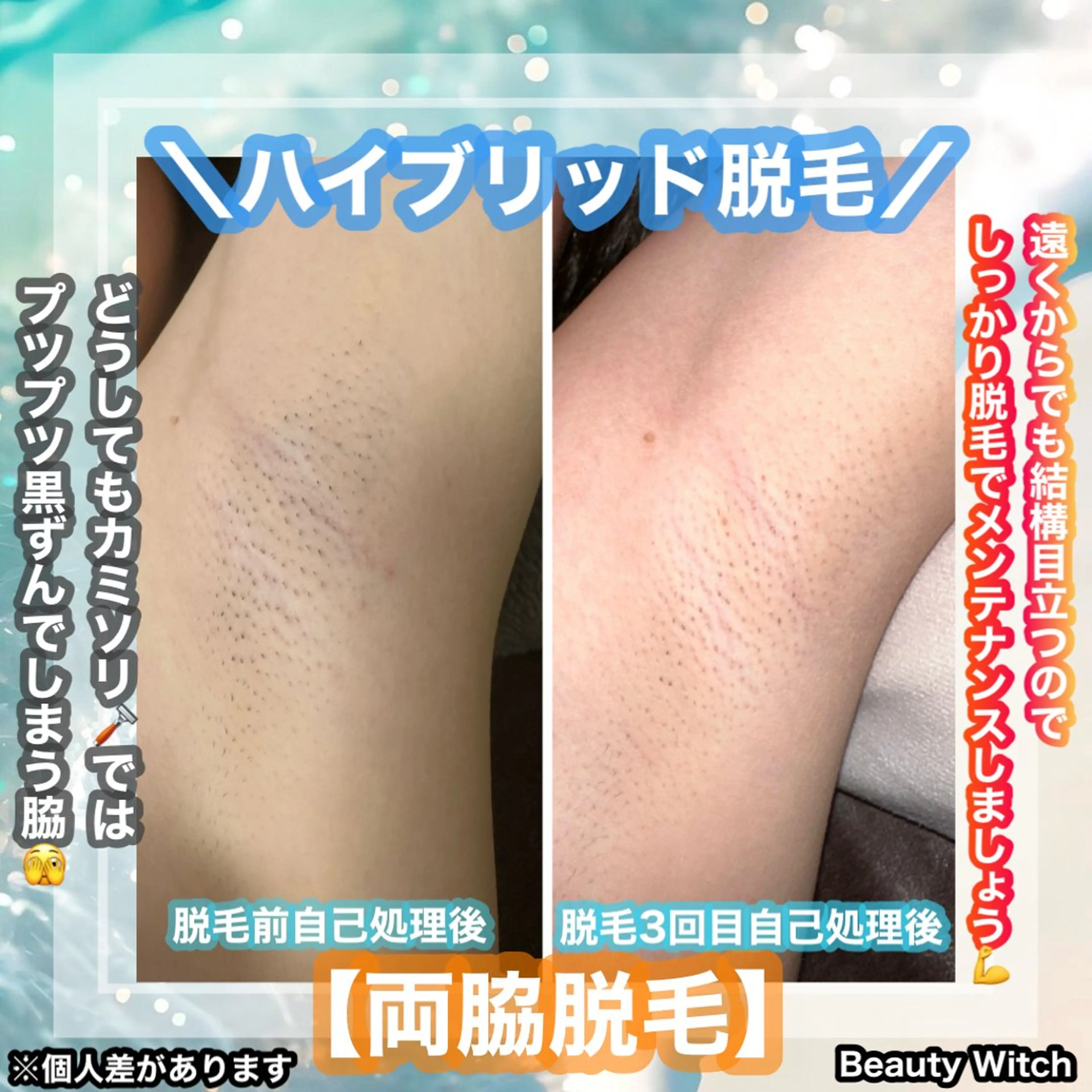 脱毛 痩身/脱毛/ネイル HARUKAのエステ・リラクイメージ