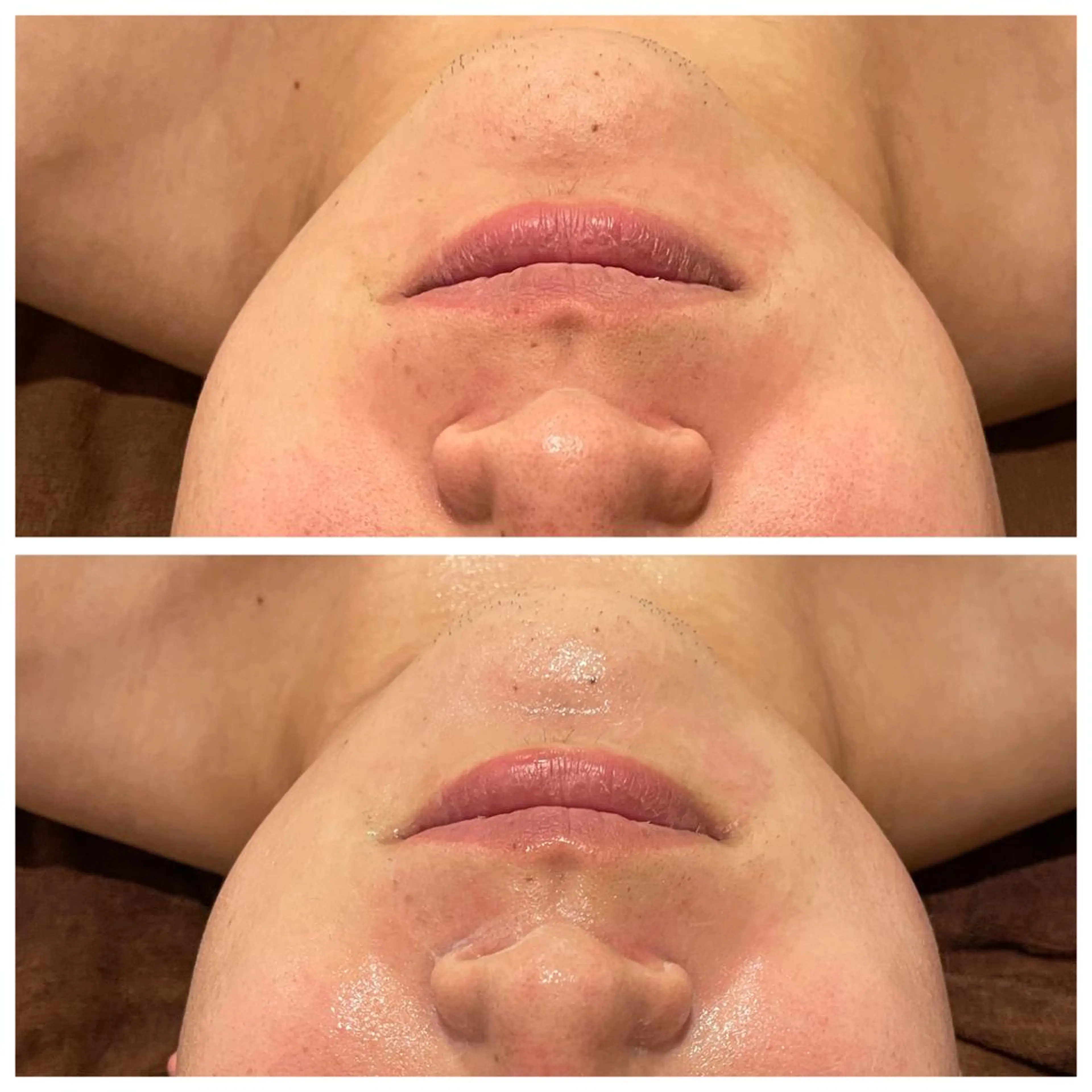 メンズ エステ Meow！～トラブル肌専門ピーリング＆脱毛サロン～所属・トラブル肌改善🏥 Meow！🫧🫧のその他イメージ