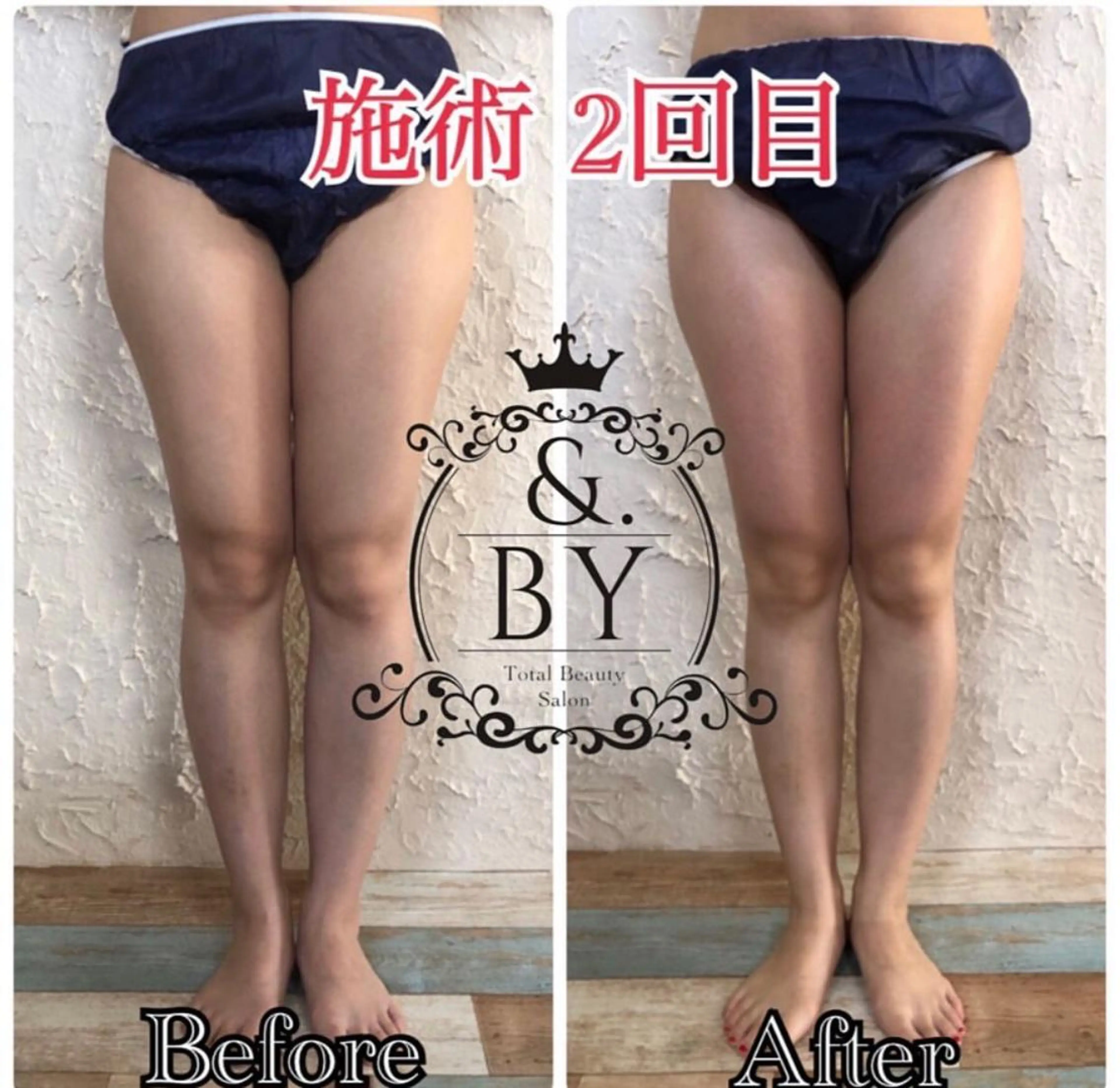 &. BYのエステ・リラクイメージ