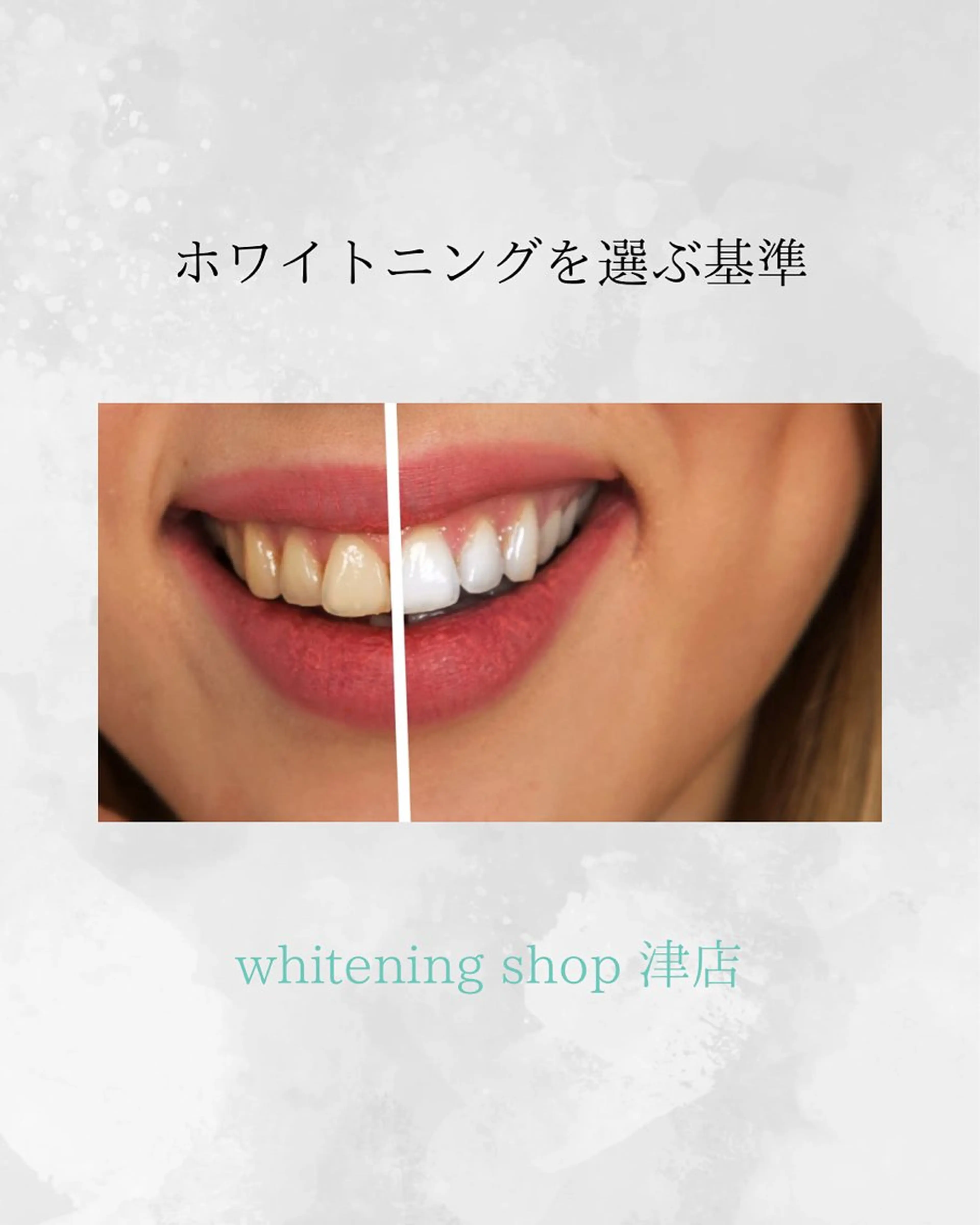 ホワイトニングショップ津店所属・ホワイトニング ショップ津店のその他イメージ