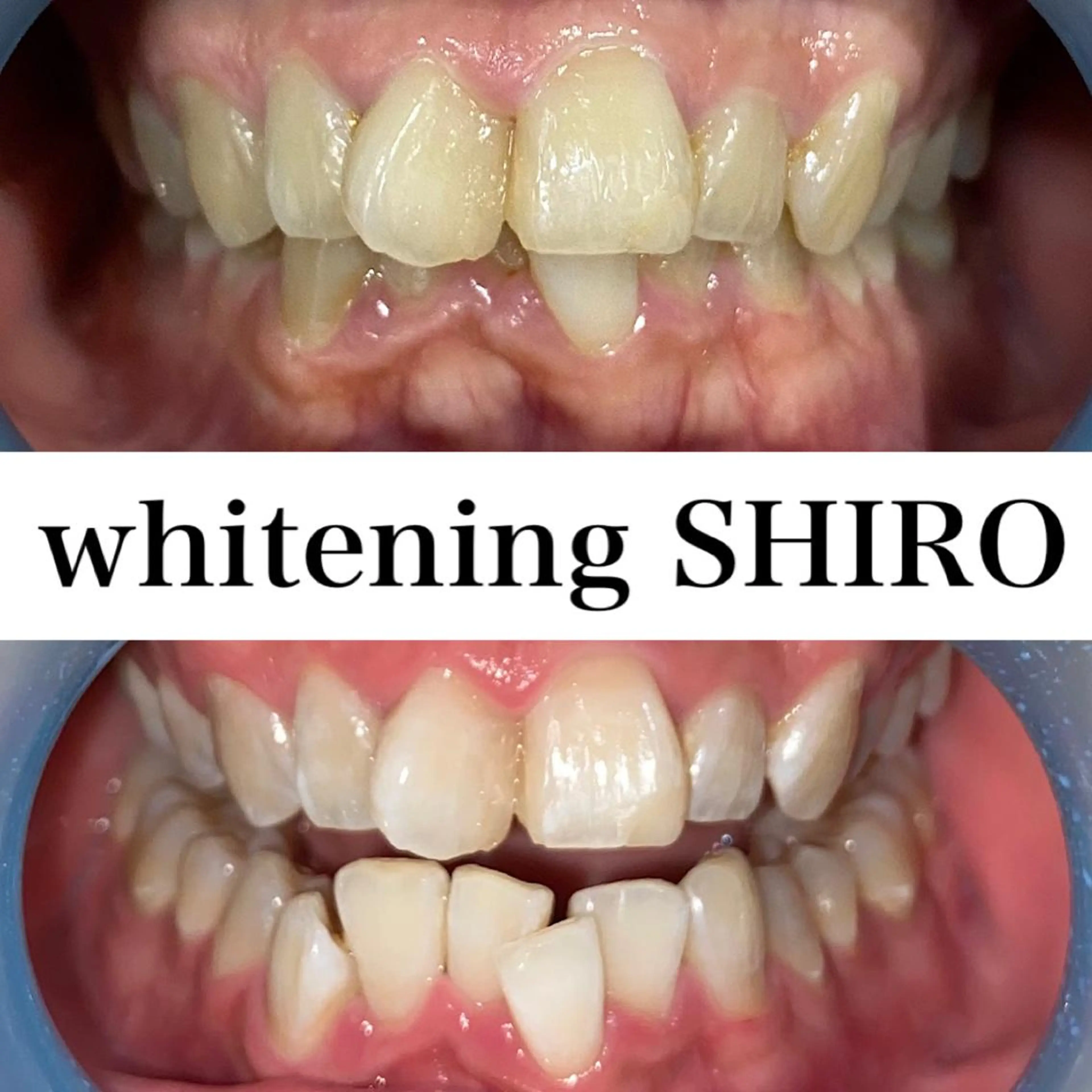 福岡ホワイトニング SHIRO天神店のエステ・リラクイメージ