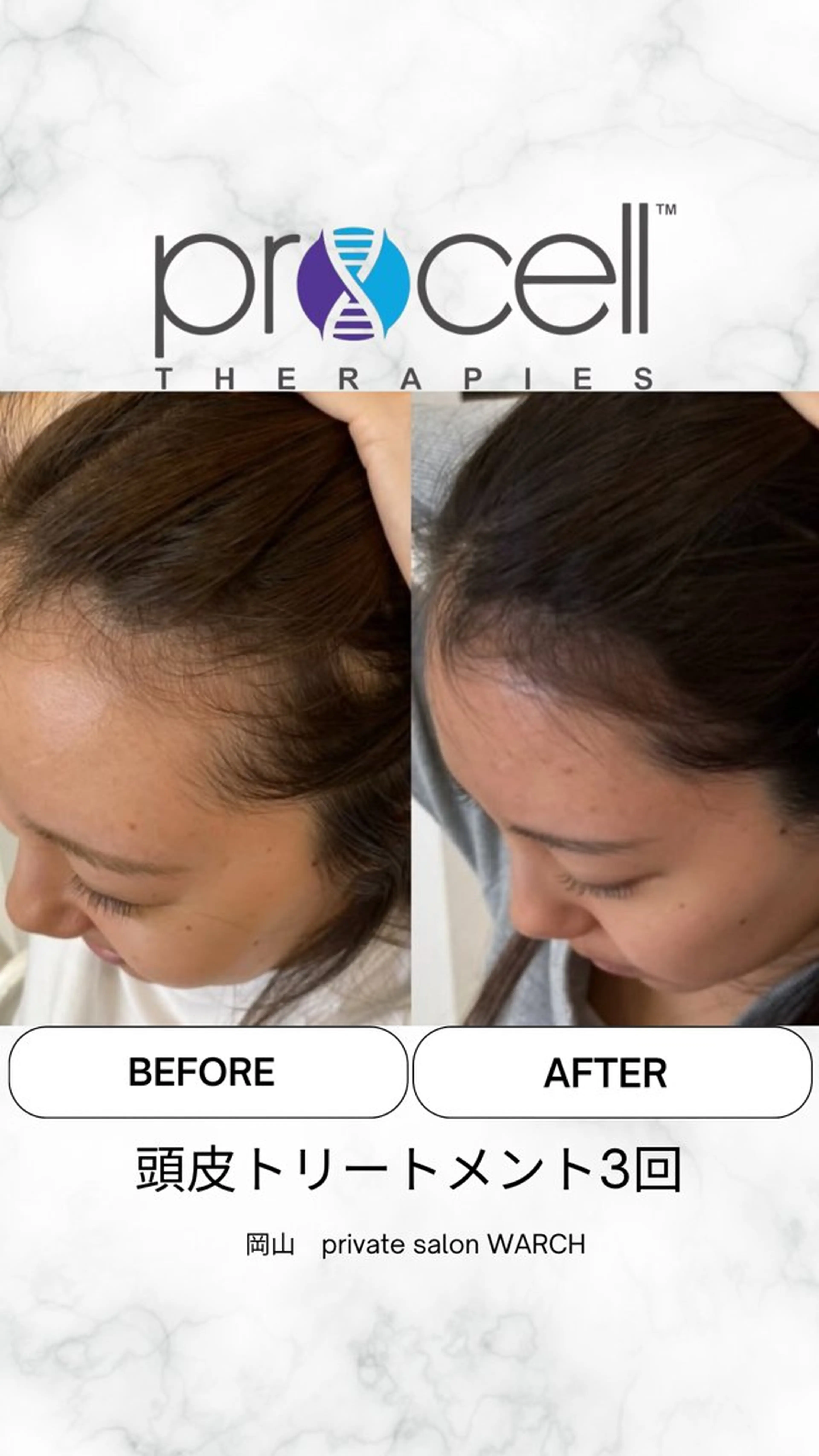 WARCH Marieのその他イメージ