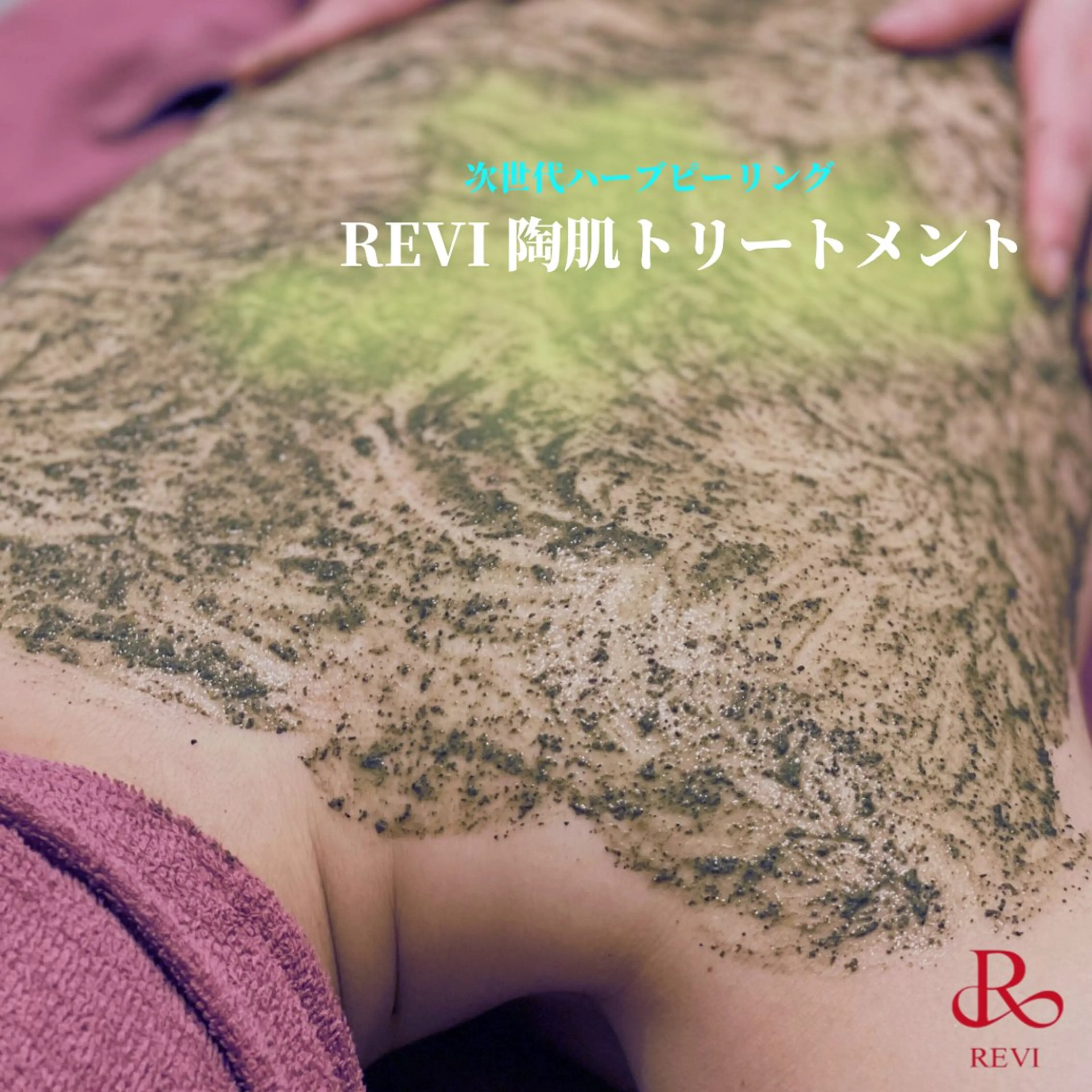 【REVI 陶肌トリートメント/背中】※剥離なし▶︎ 背中ニキビケア・ブライダルにもオススメ💍の写真