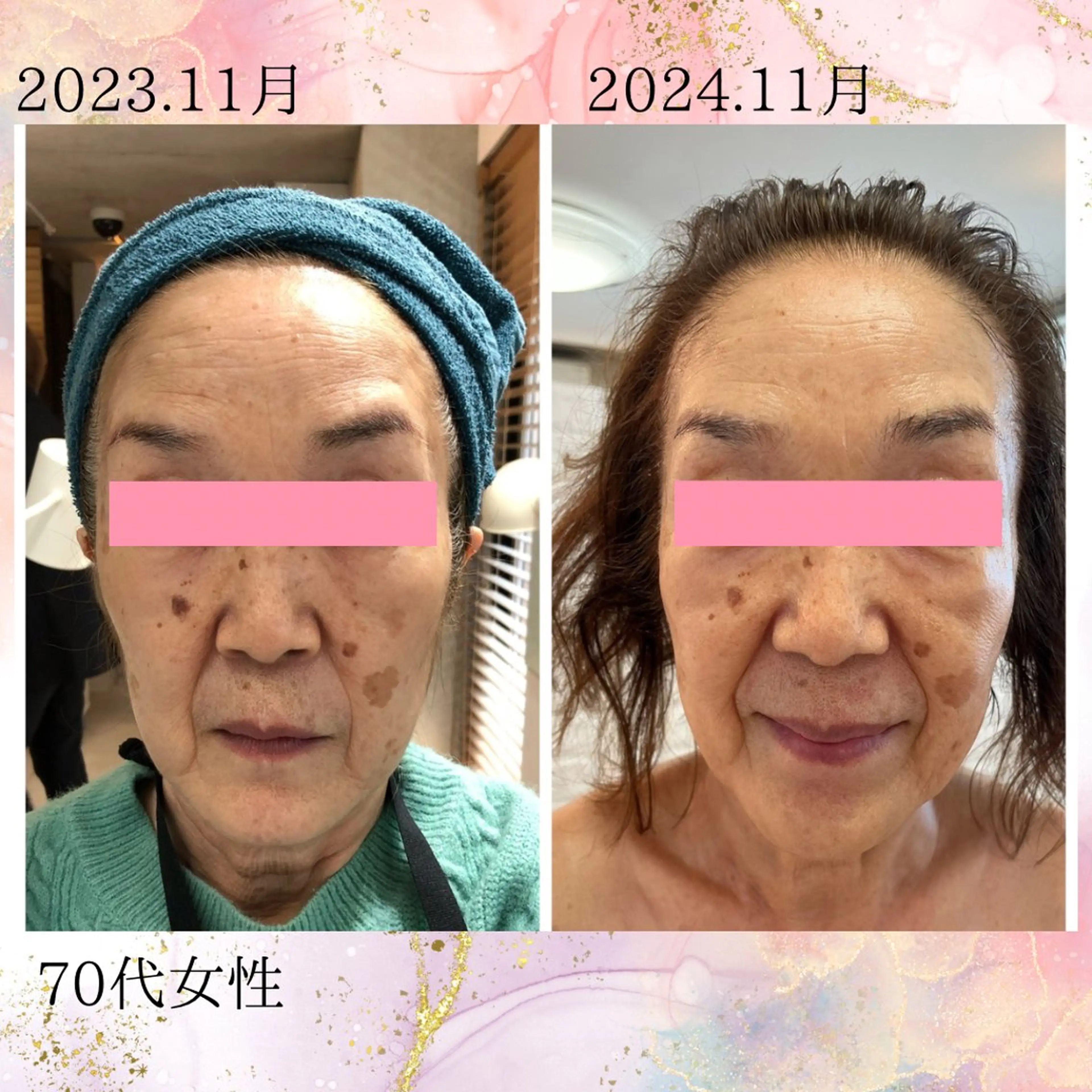 エステ エステ　マリンゴ所属・石川 華美の眉毛・アイブロウイメージ