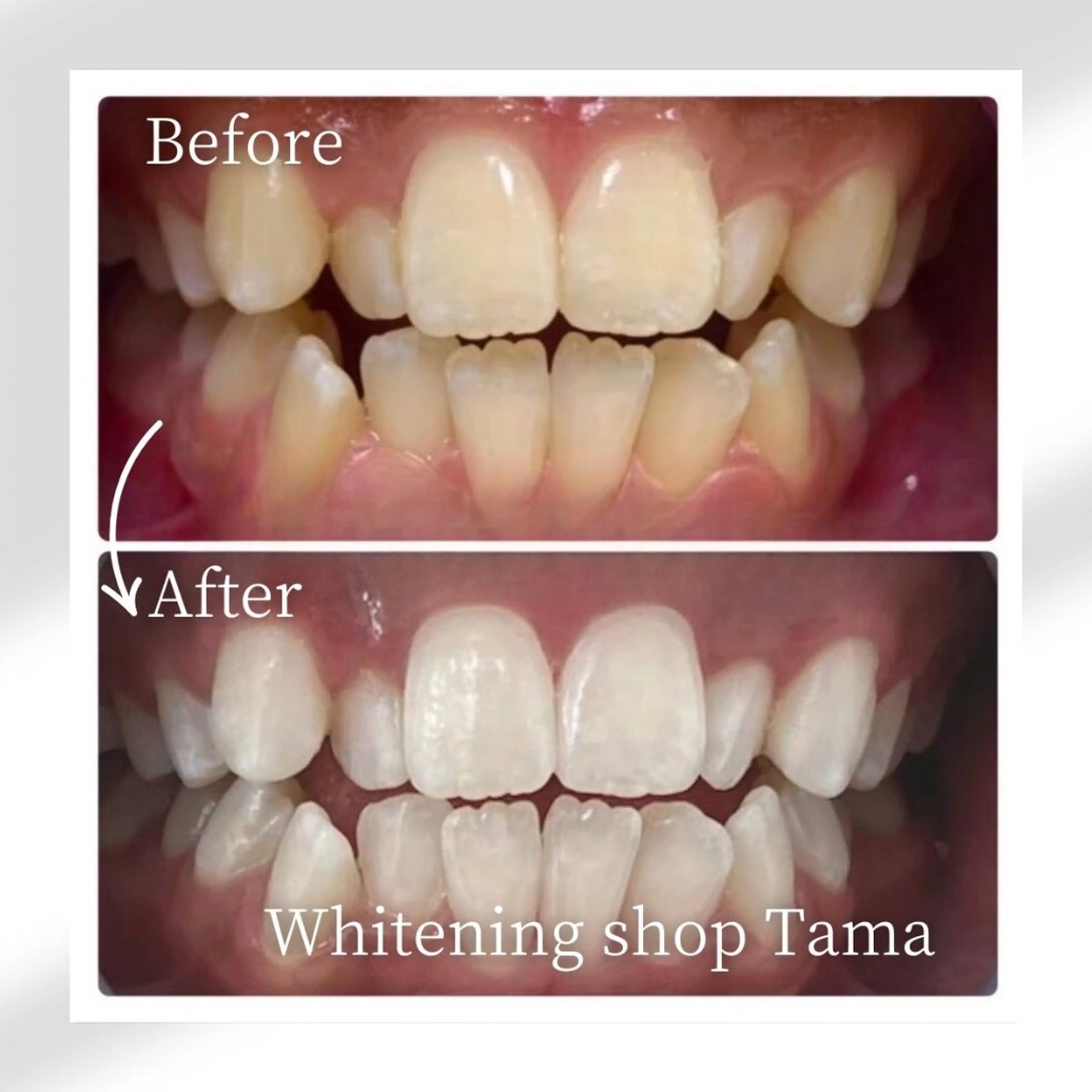 メンズ ホワイトニング ショップ多摩店のその他イメージ