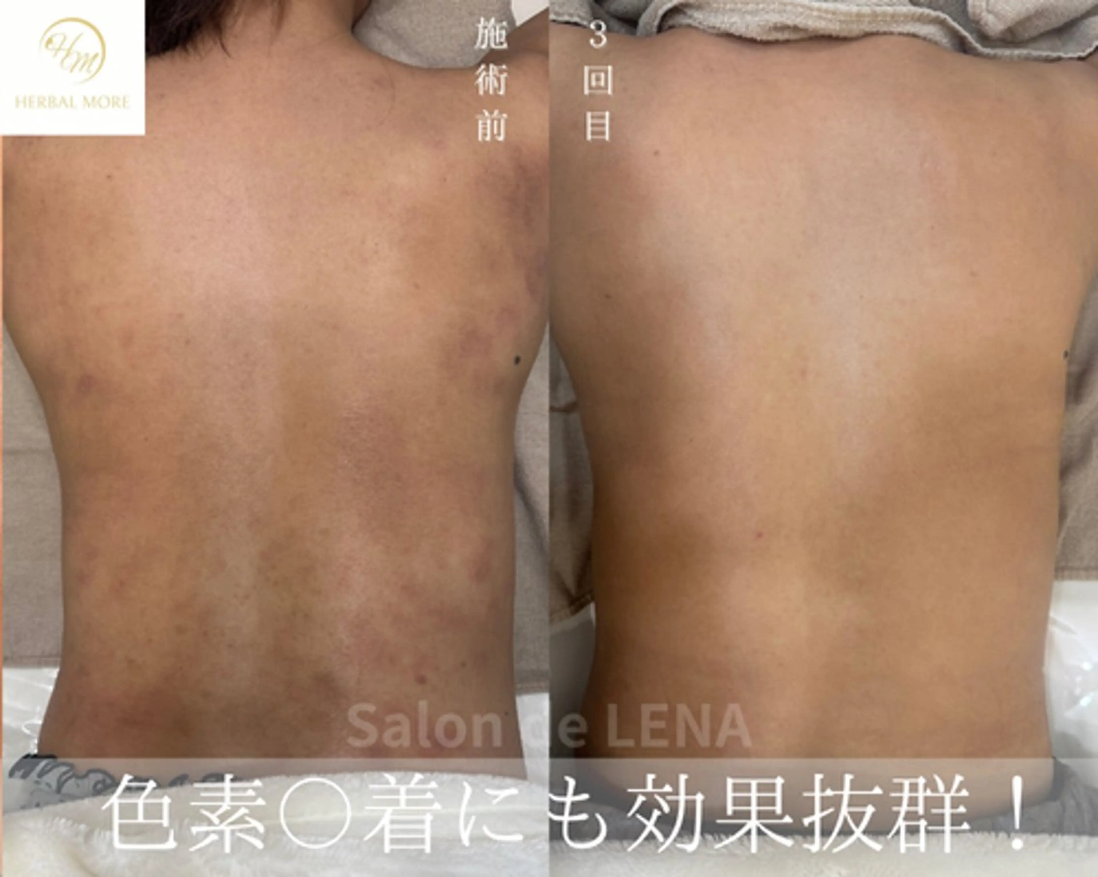 ハーブピーリング・毛穴ケア専門サロンSalon de LENA 栄店所属・ハーブピーリング専門 サロンドレナ　白藤のエステ・リラクイメージ