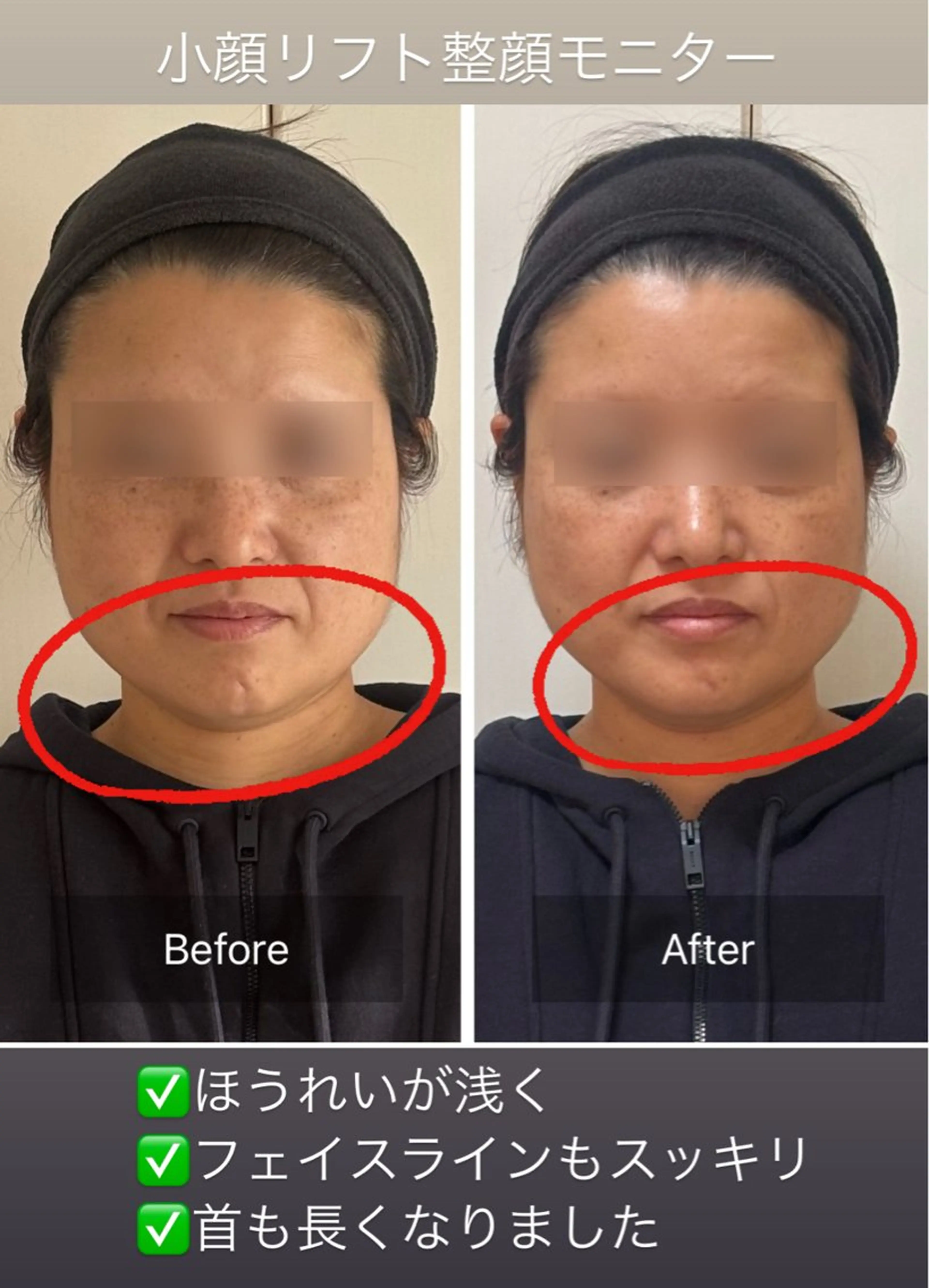 その他 小顔リフト整顔/ 美肌サロンのその他イメージ