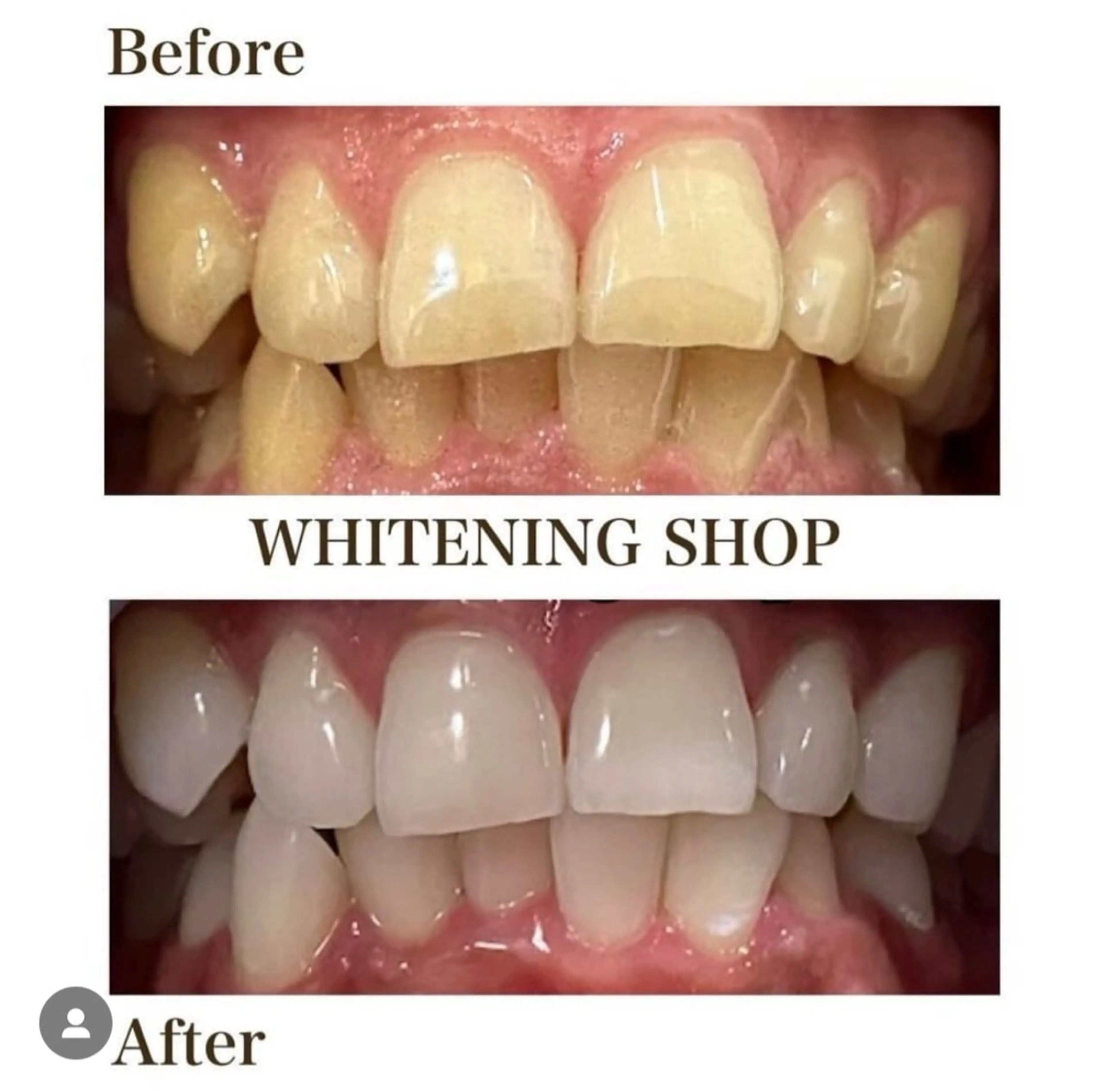 ホワイトニングショップ伊丹店所属・ホワイトニング ショップ伊丹店のその他イメージ