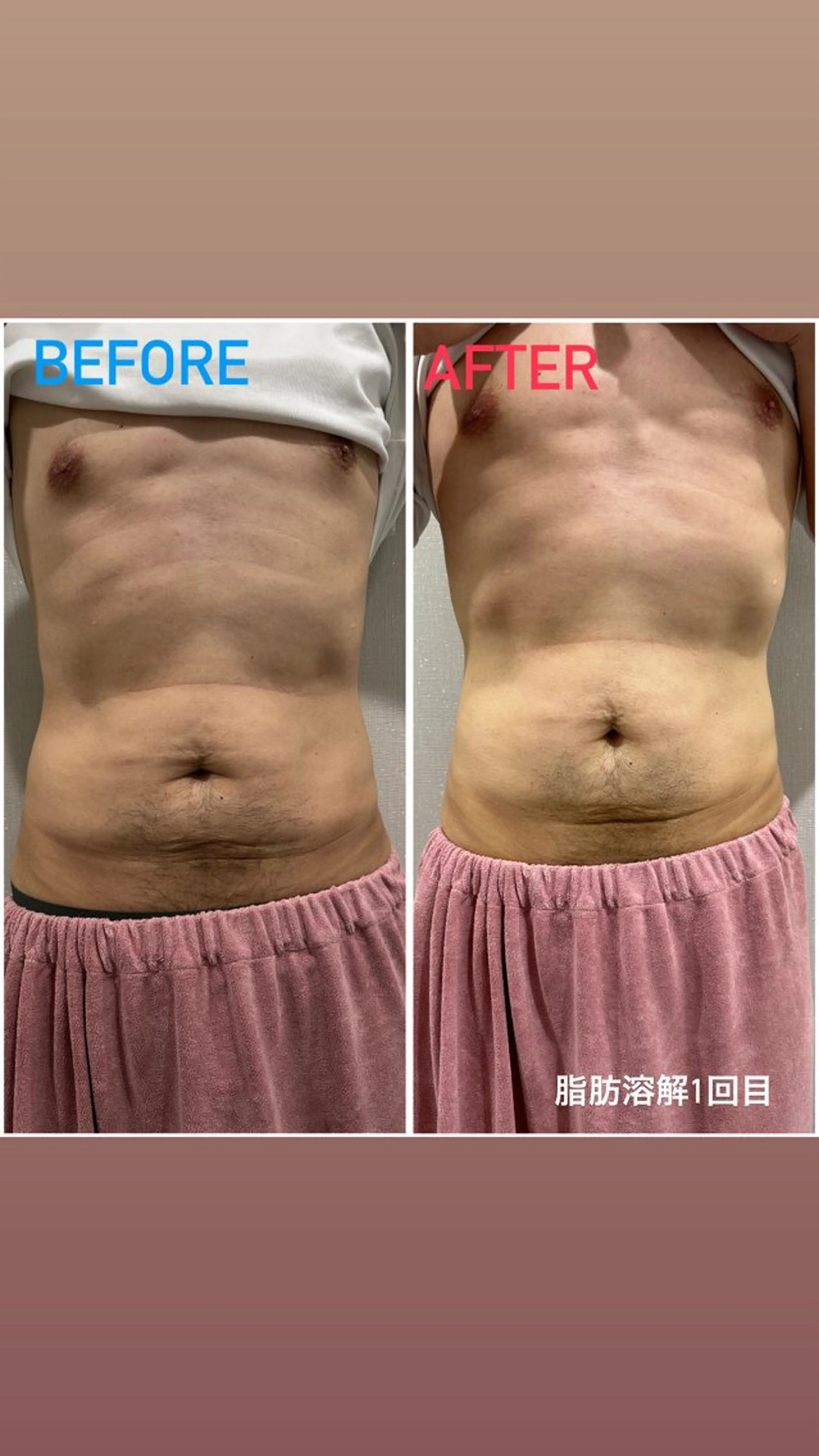 エステ アルカンジュ~archange~所属・痩身/毛穴洗浄/脱毛 アルカンジュのエステ・リラクイメージ