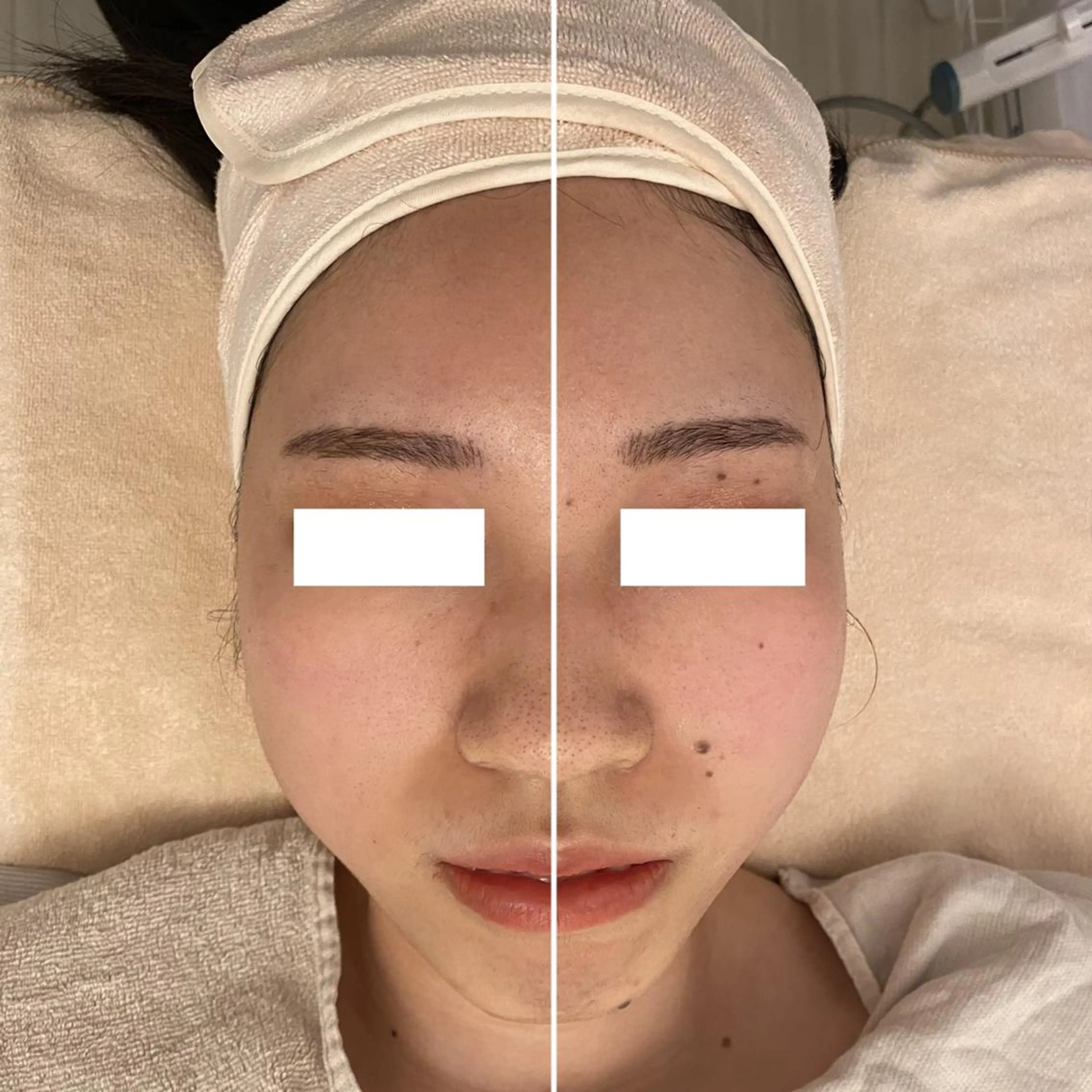 ✨美肌水光✨ アトリエリュバンのエステ・リラクイメージ