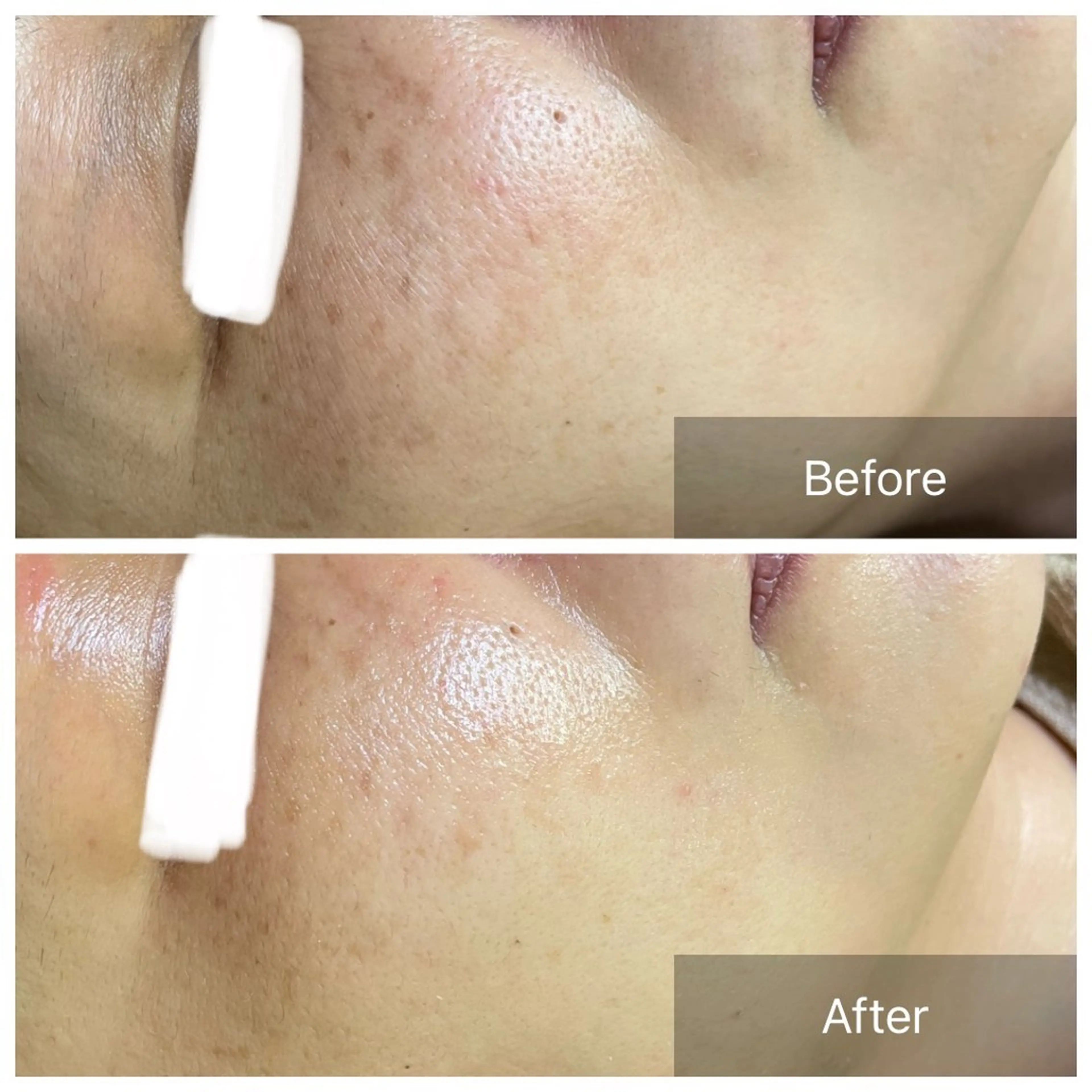 バフトアップ/ハーブ Nornのエステ・リラクイメージ