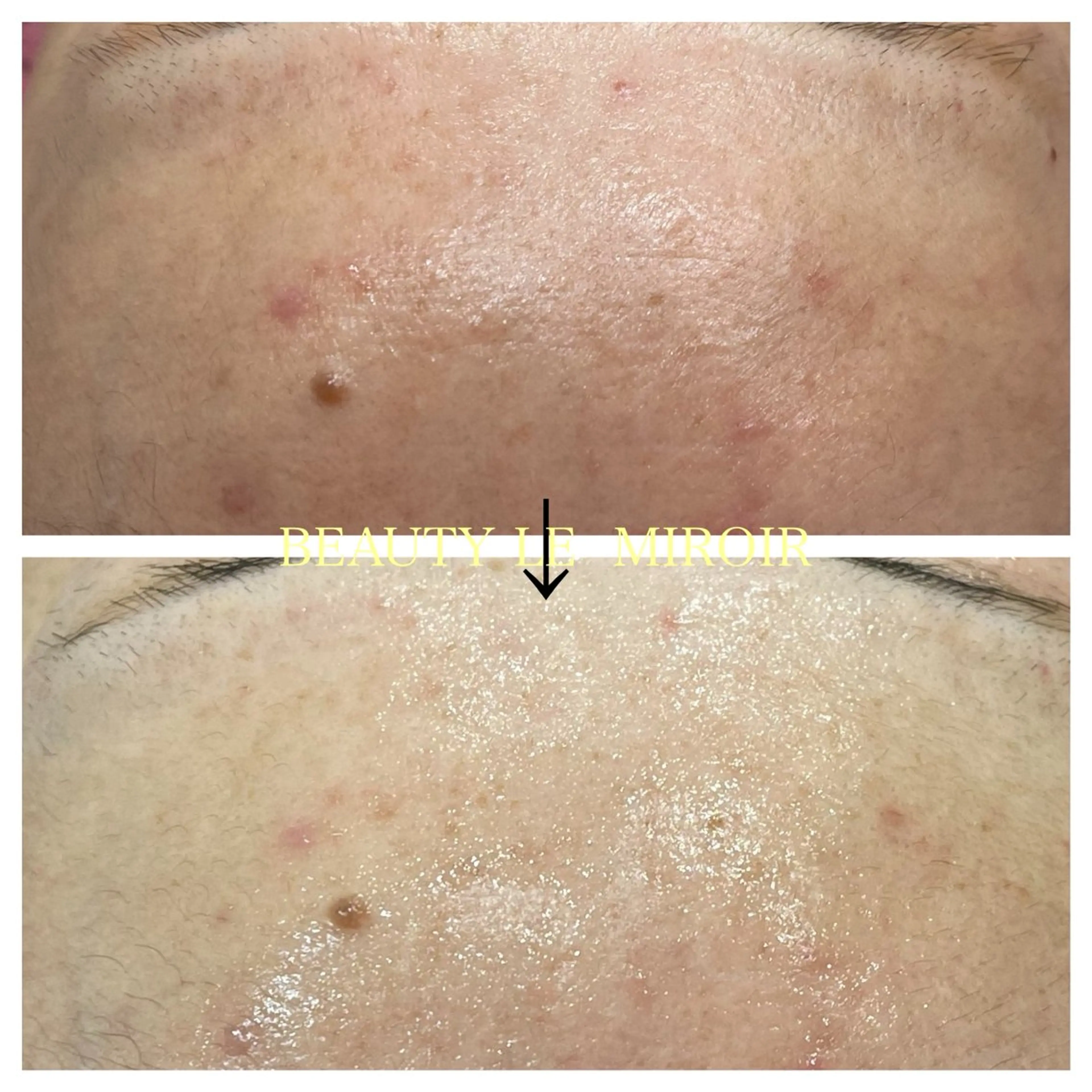 エステ ビューティー ミロワールのエステ・リラクイメージ