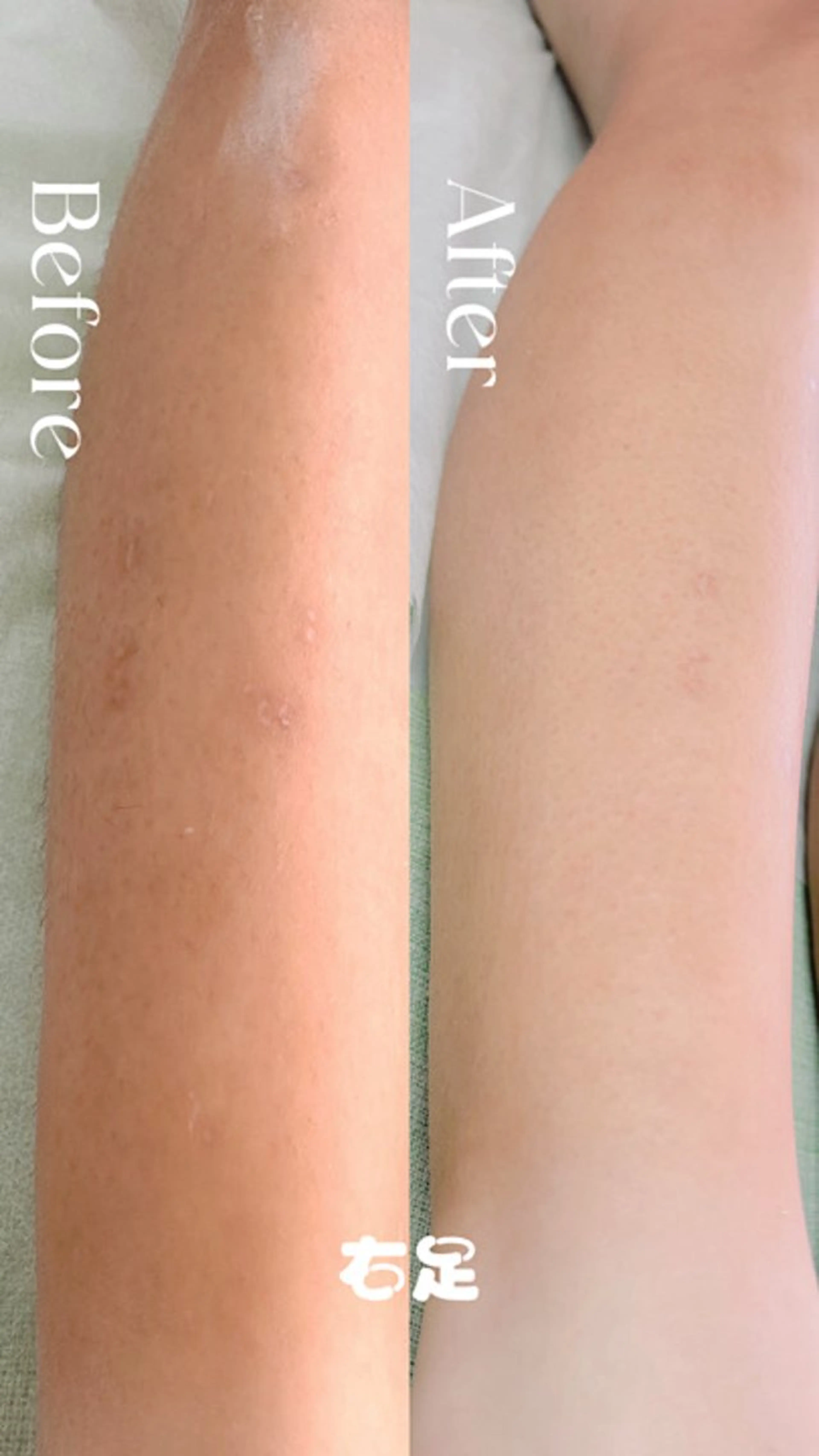 Hit. シュガーリング豊橋のエステ・リラクイメージ