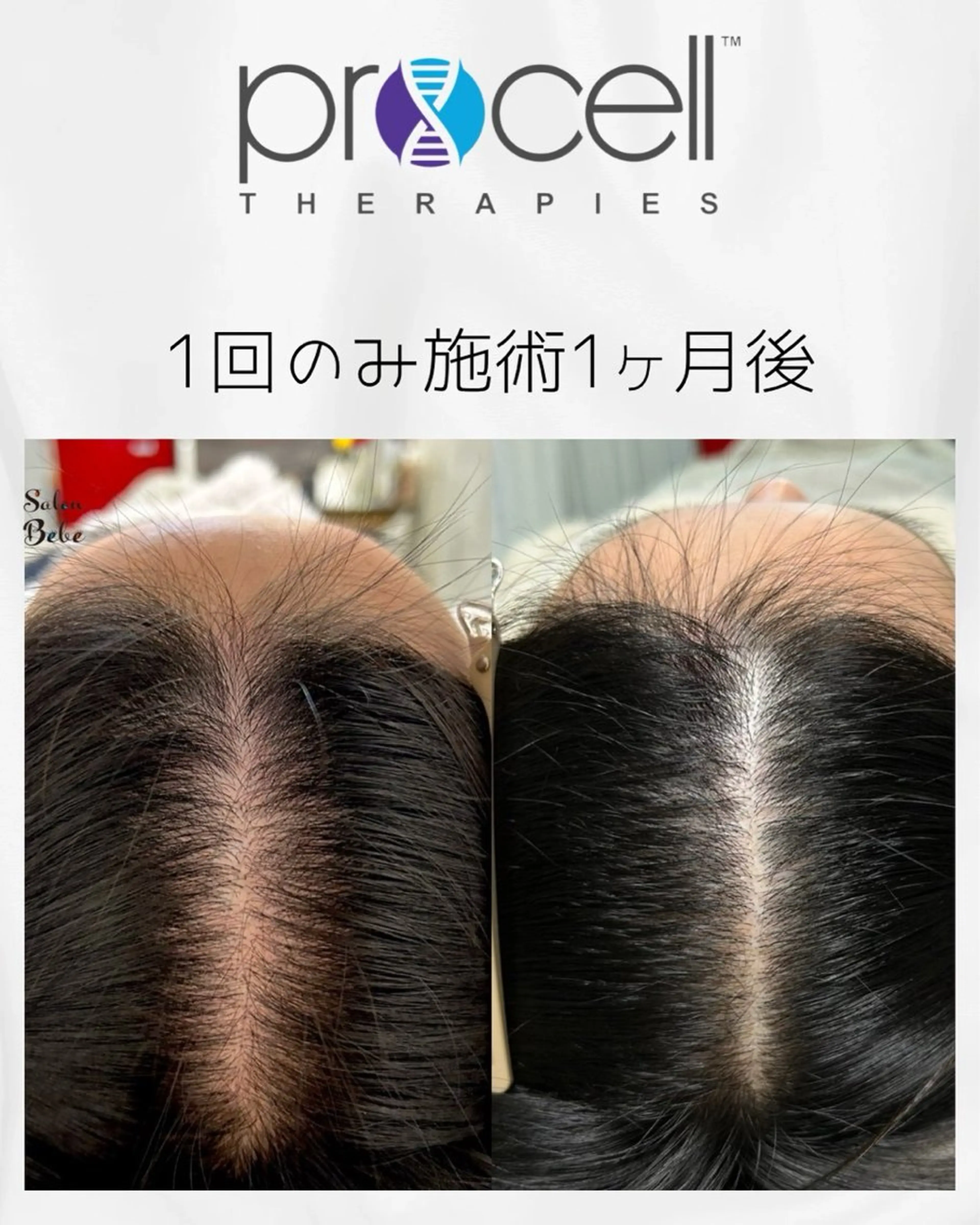 エステ Salon Bebe名古屋所属・Salon Bebe 名古屋のエステ・リラクイメージ