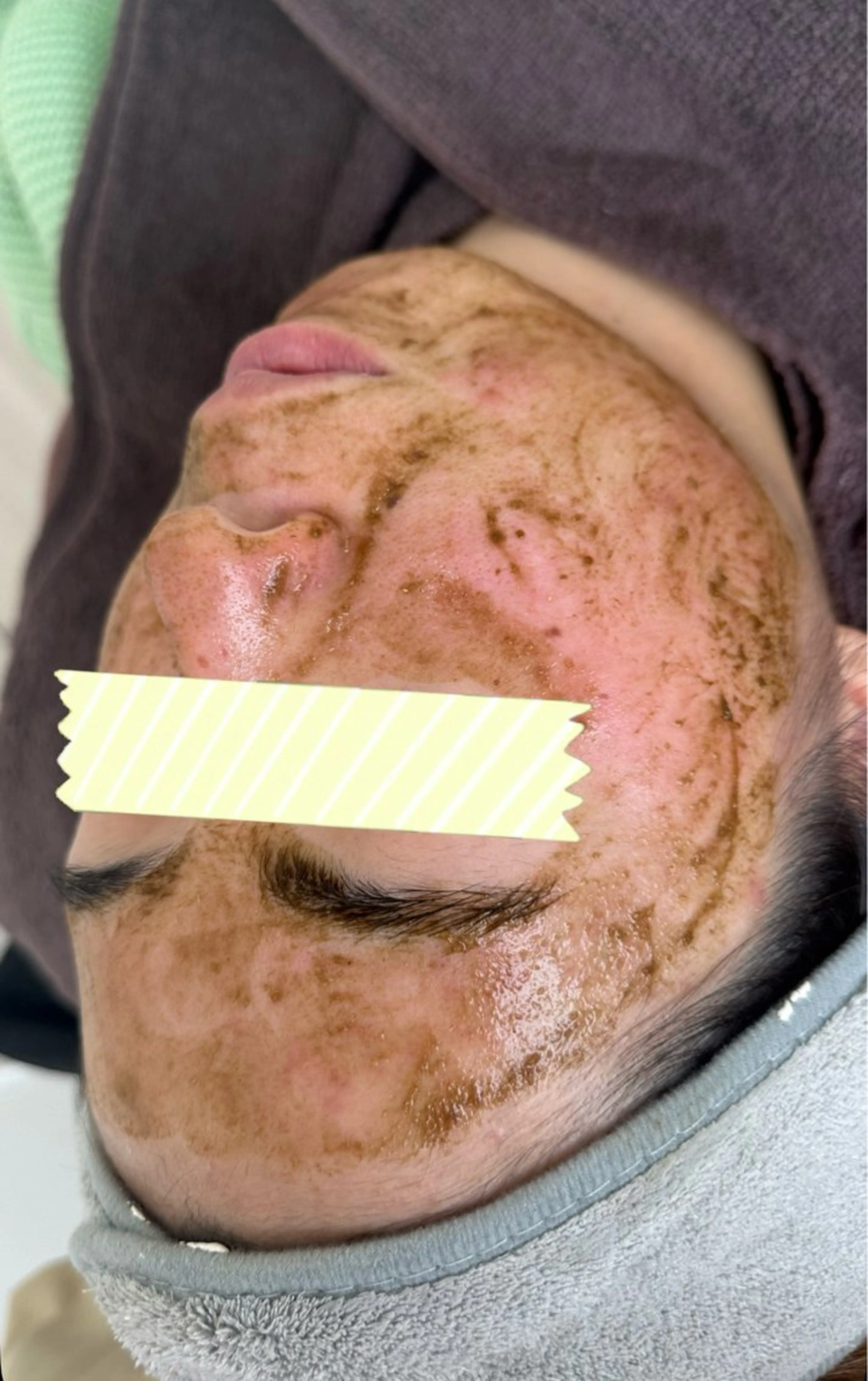 エステ トータルしみケア専門 NICA(ニカ)のエステ・リラクイメージ