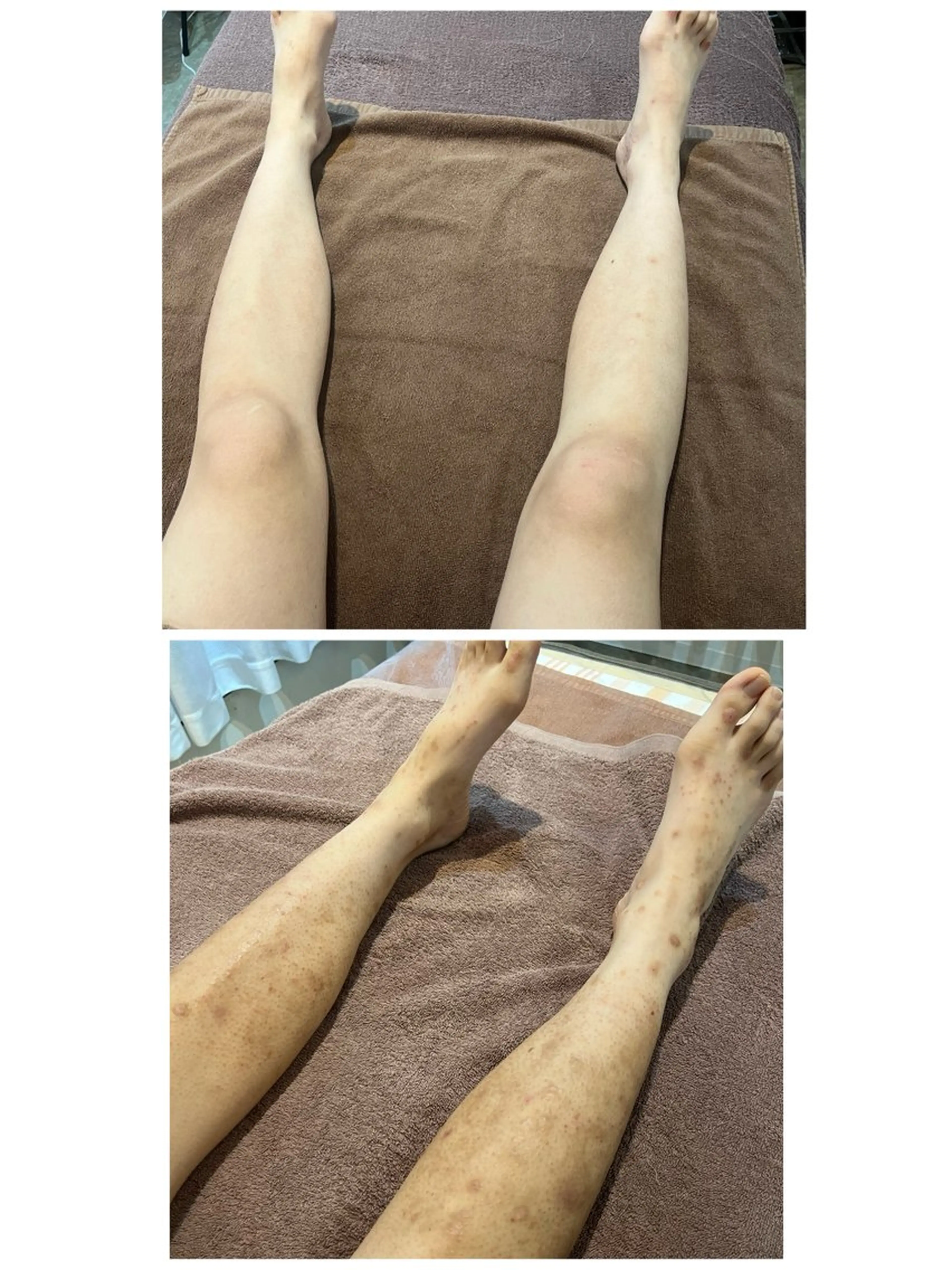 バストアップ・痩身 脱毛/🌺コオリナのエステ・リラクイメージ