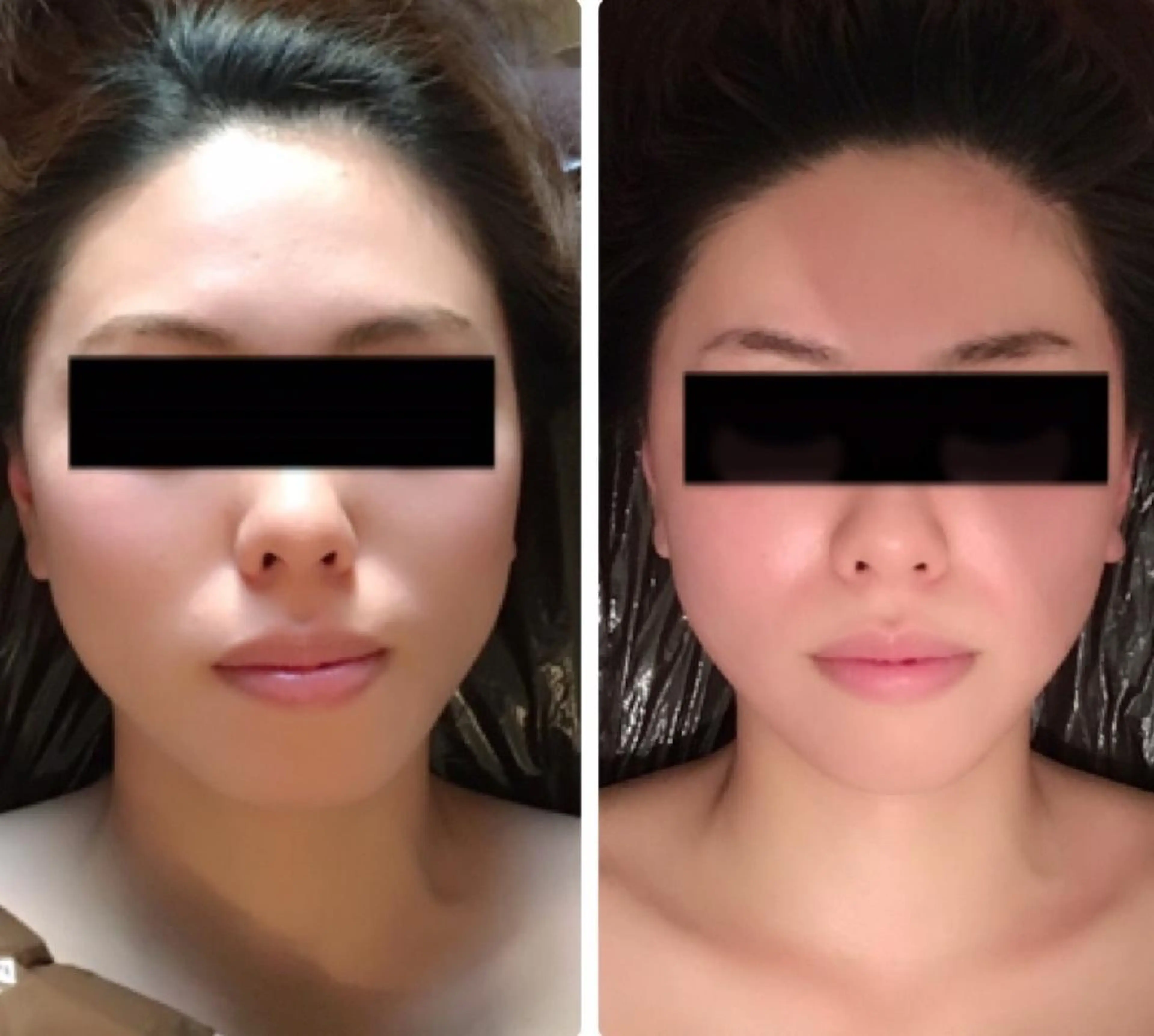 エステ 小顔•美肌•まつ毛 サロン　Mimiの眉毛・アイブロウイメージ