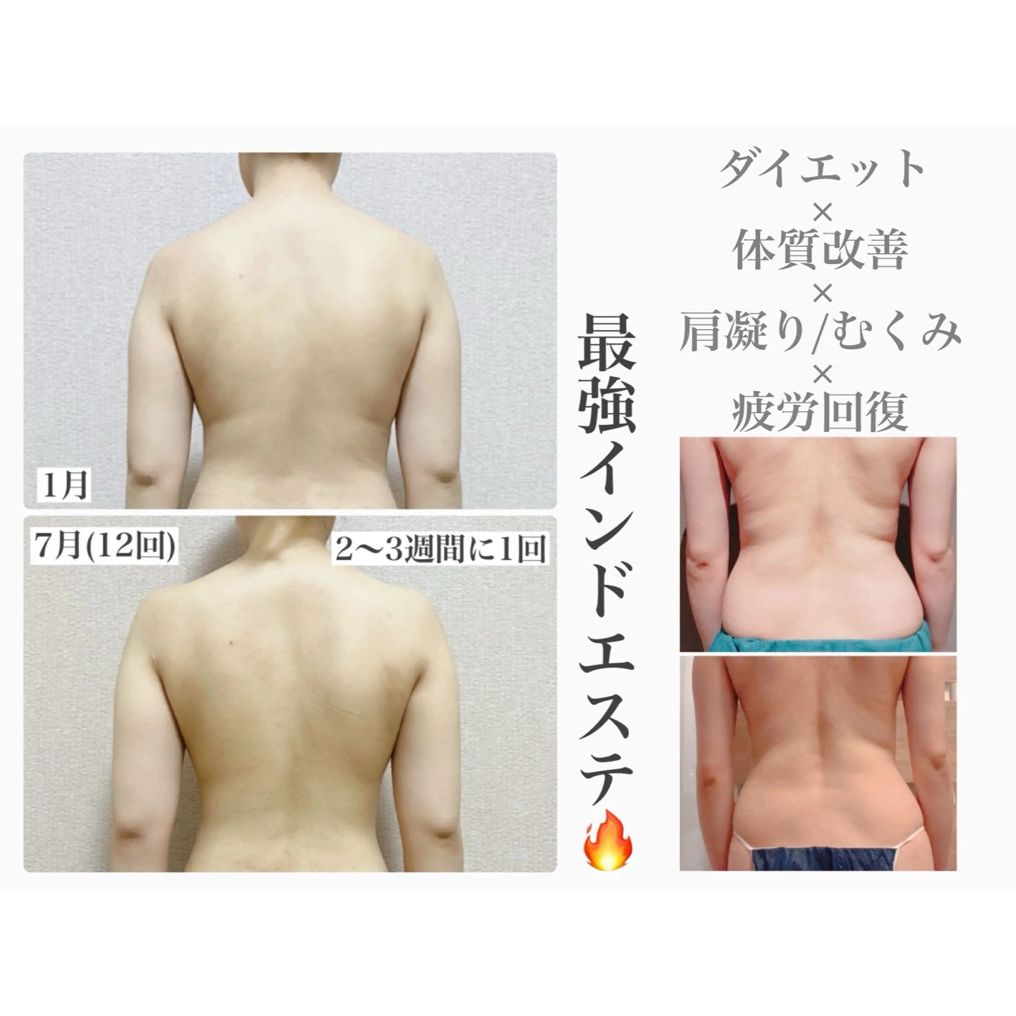 mooi【モーイ】所属・【北堀江】 痩身/小顔　mooiのエステ・リラクイメージ