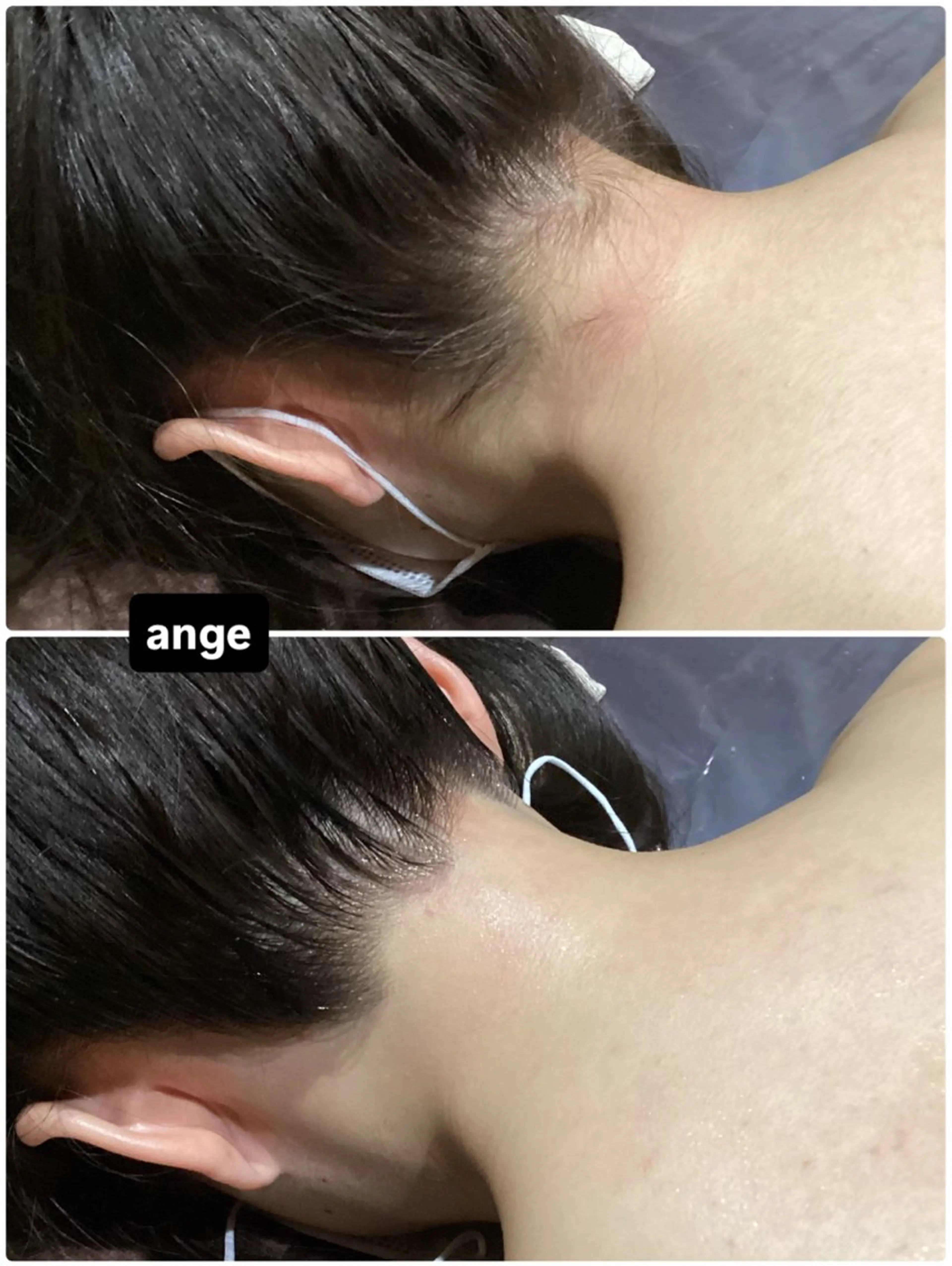 脱毛 Ange -viva la vida-所属・Esthesalon -Ange-のエステ・リラクイメージ