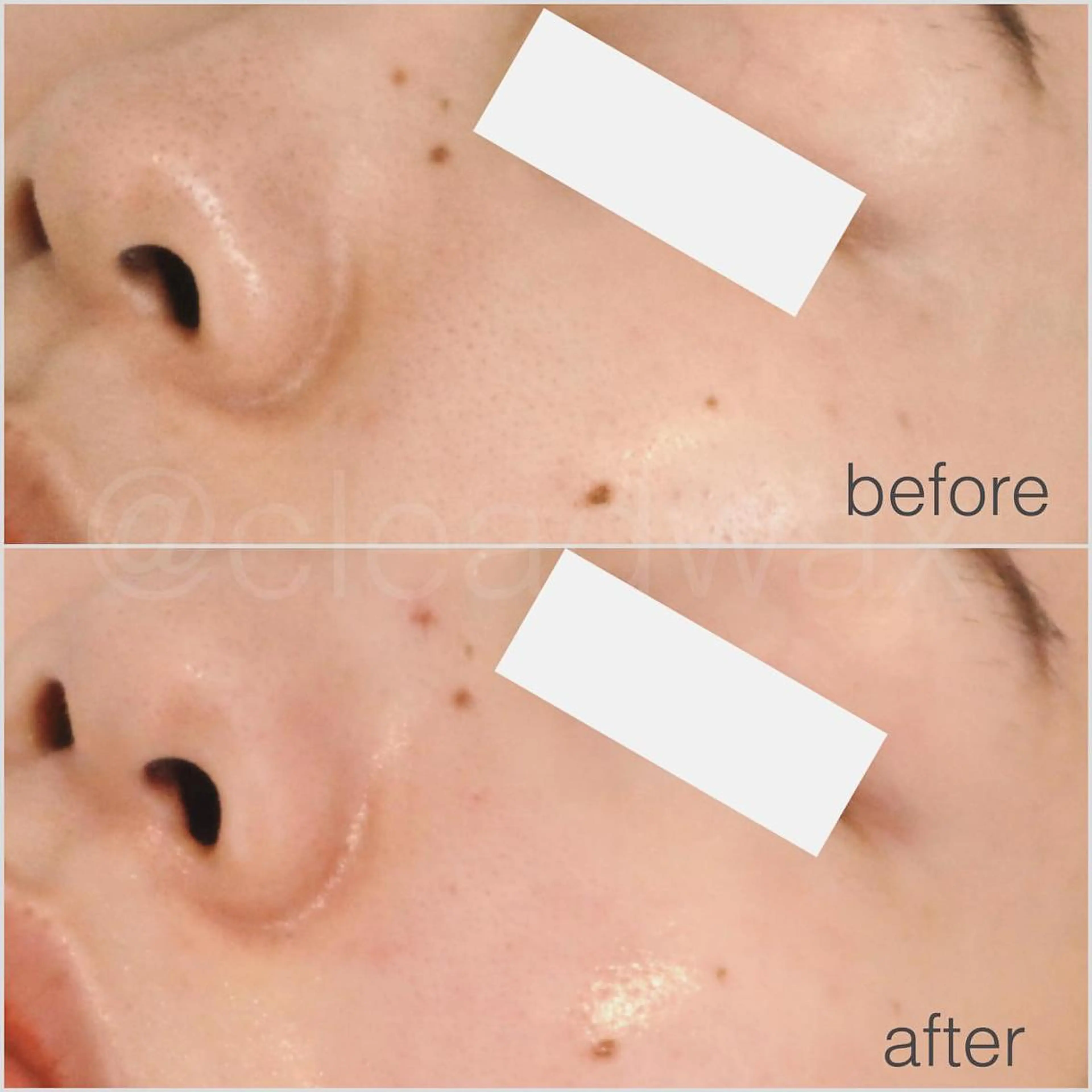 CLEAD赤坂見附店 坂田のエステ・リラクイメージ