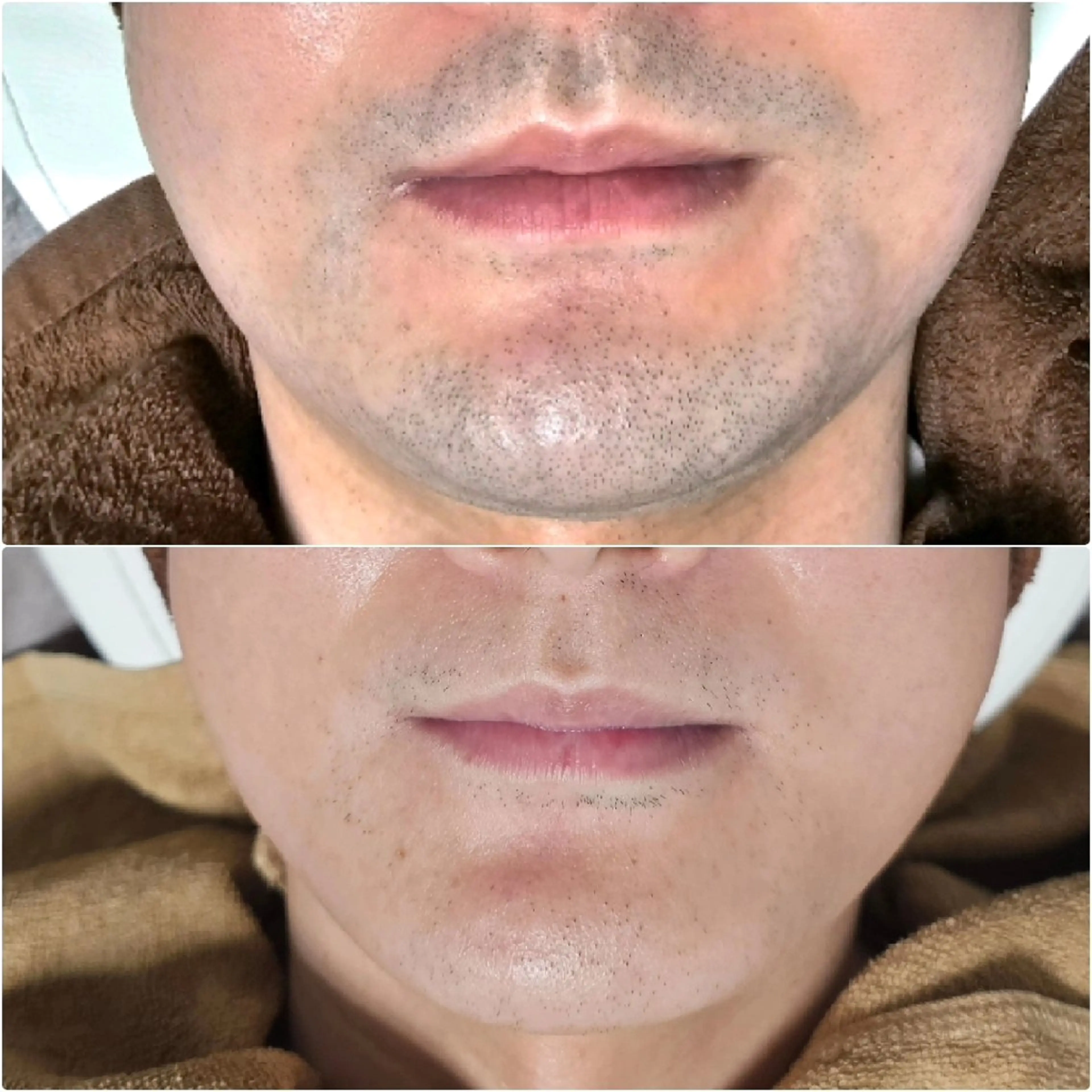 メンズ Iryアイリー所属・Iry アイリーのエステ・リラクイメージ