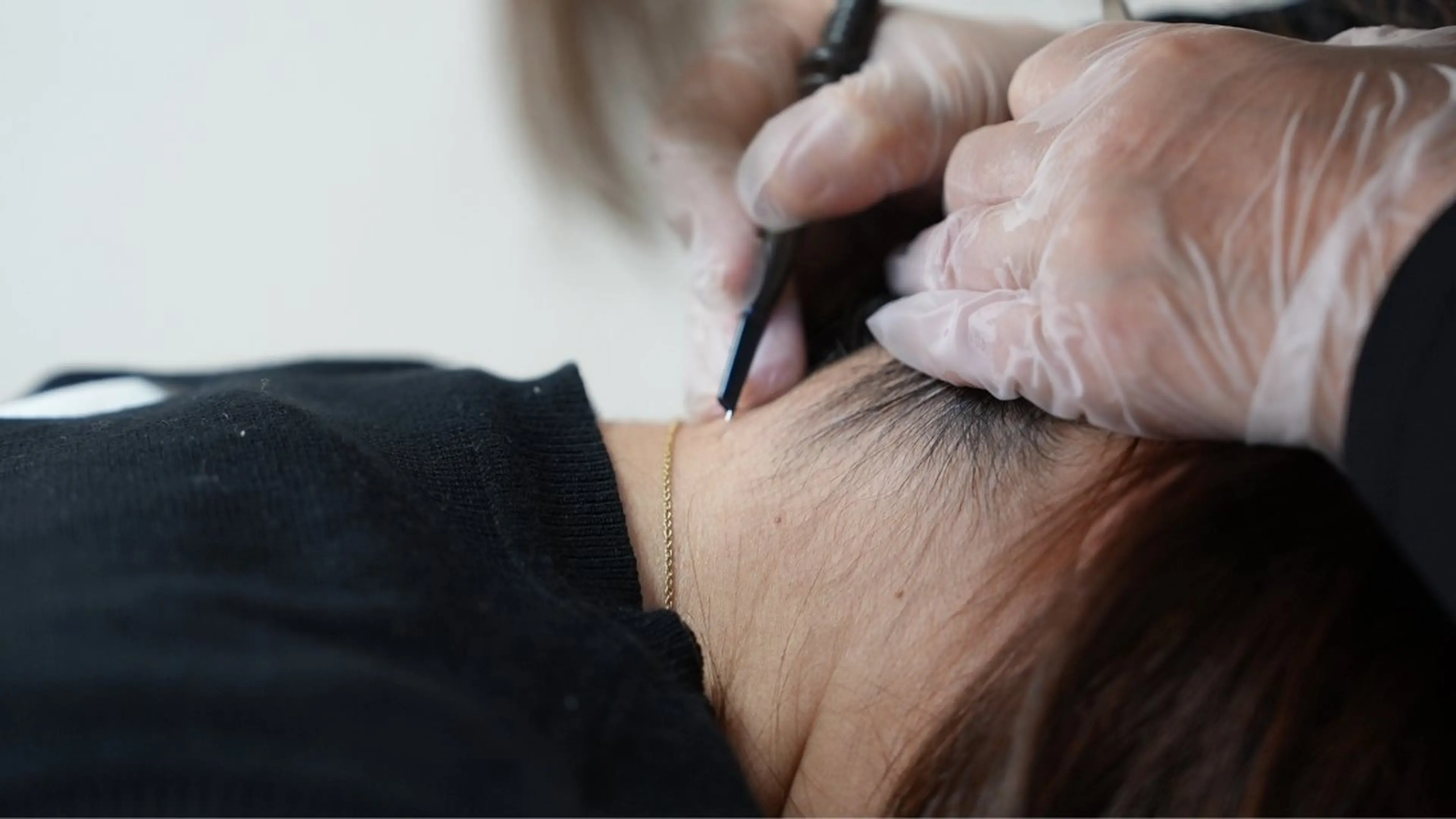 ✨美容電気脱毛モニター男女可✨VIOなし25分＋5分−15℃冷却　￥5000(現金支払いのみ)の写真