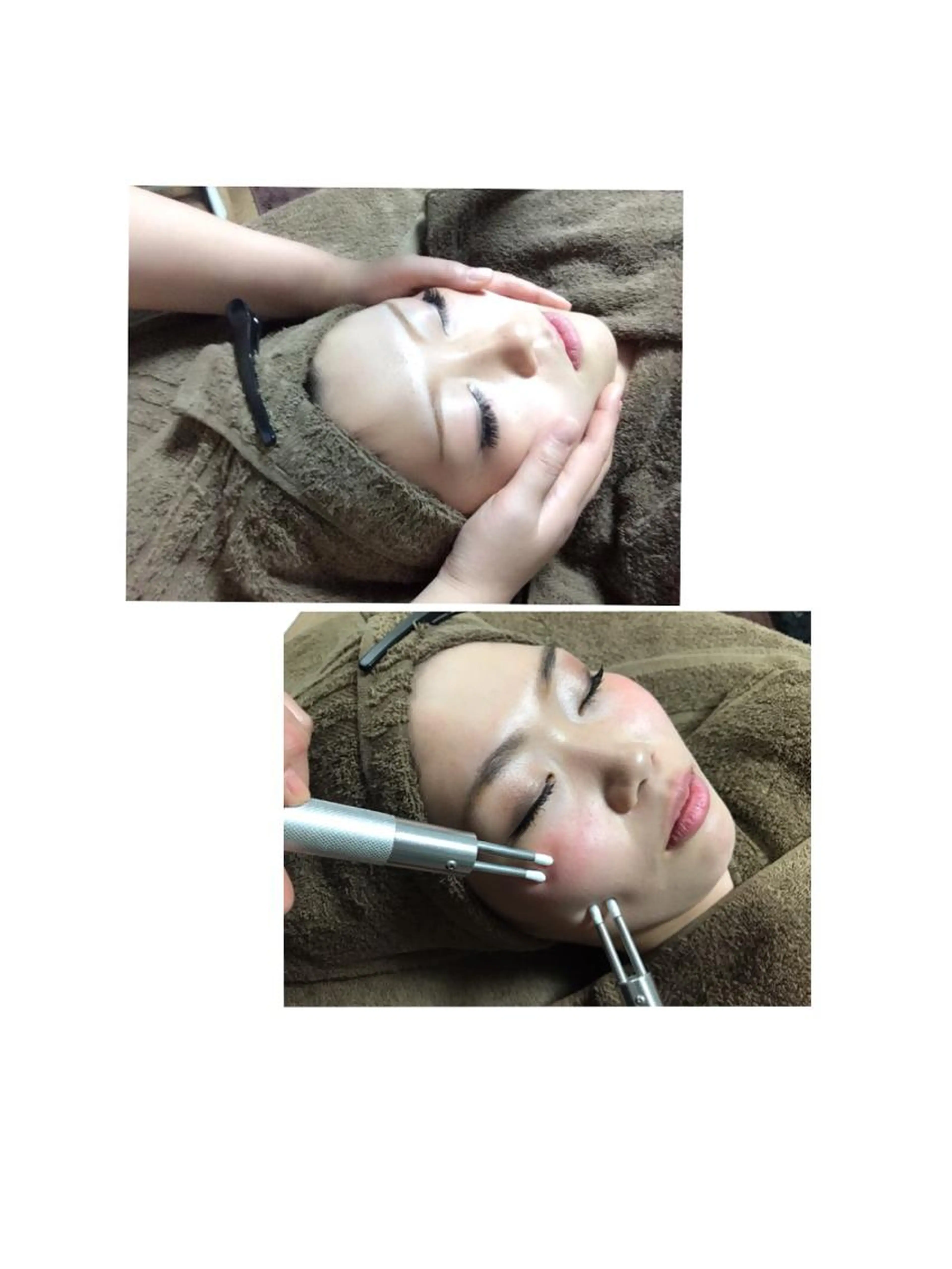 【ご新規様限定】🍀リフトUP 集中コース🍀の写真