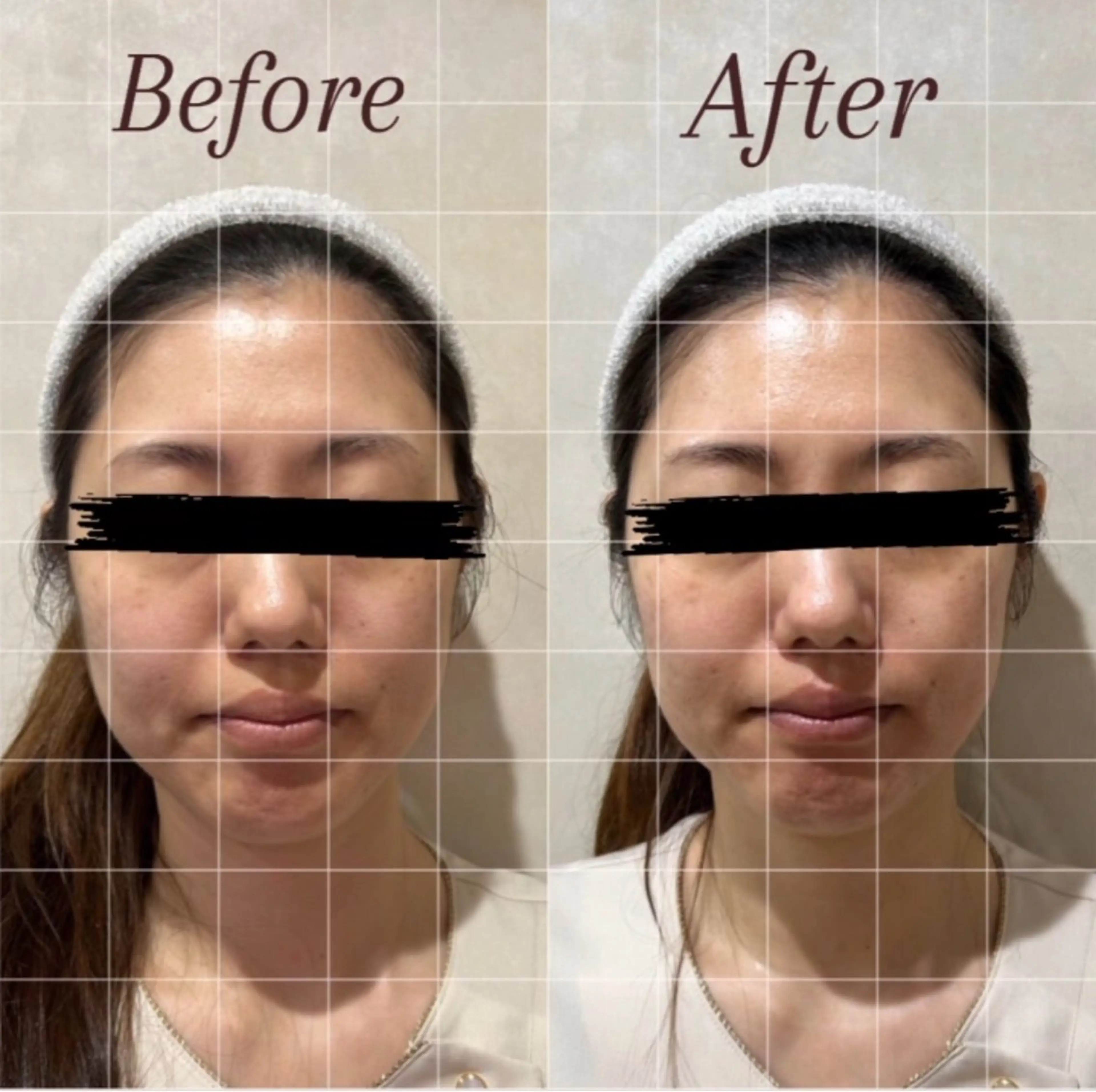 美顔フォト🧏🏻の写真