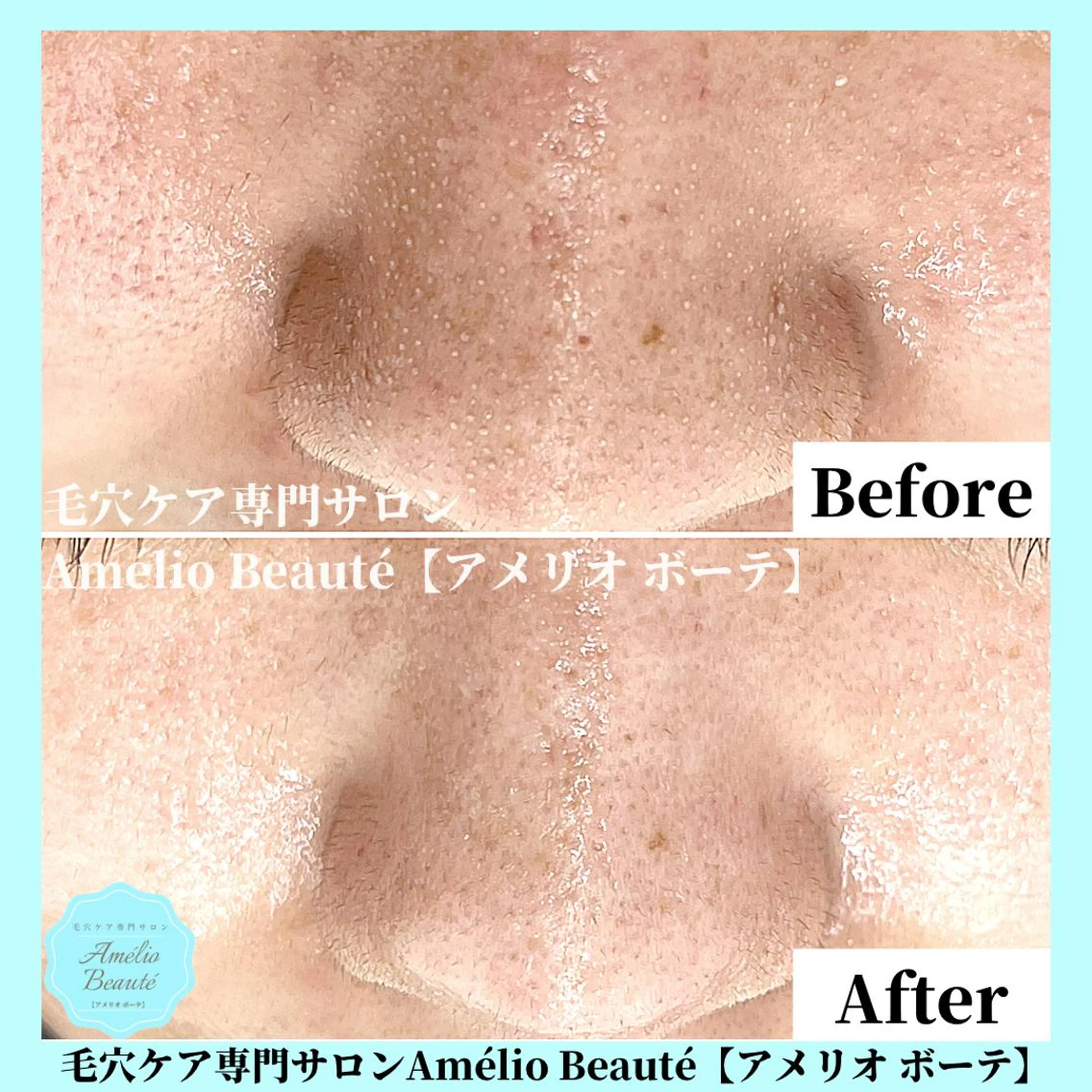 毛穴ケア専門サロン Amélio Beauté所属・毛穴ケア専門サロン アメリオボーテのその他イメージ