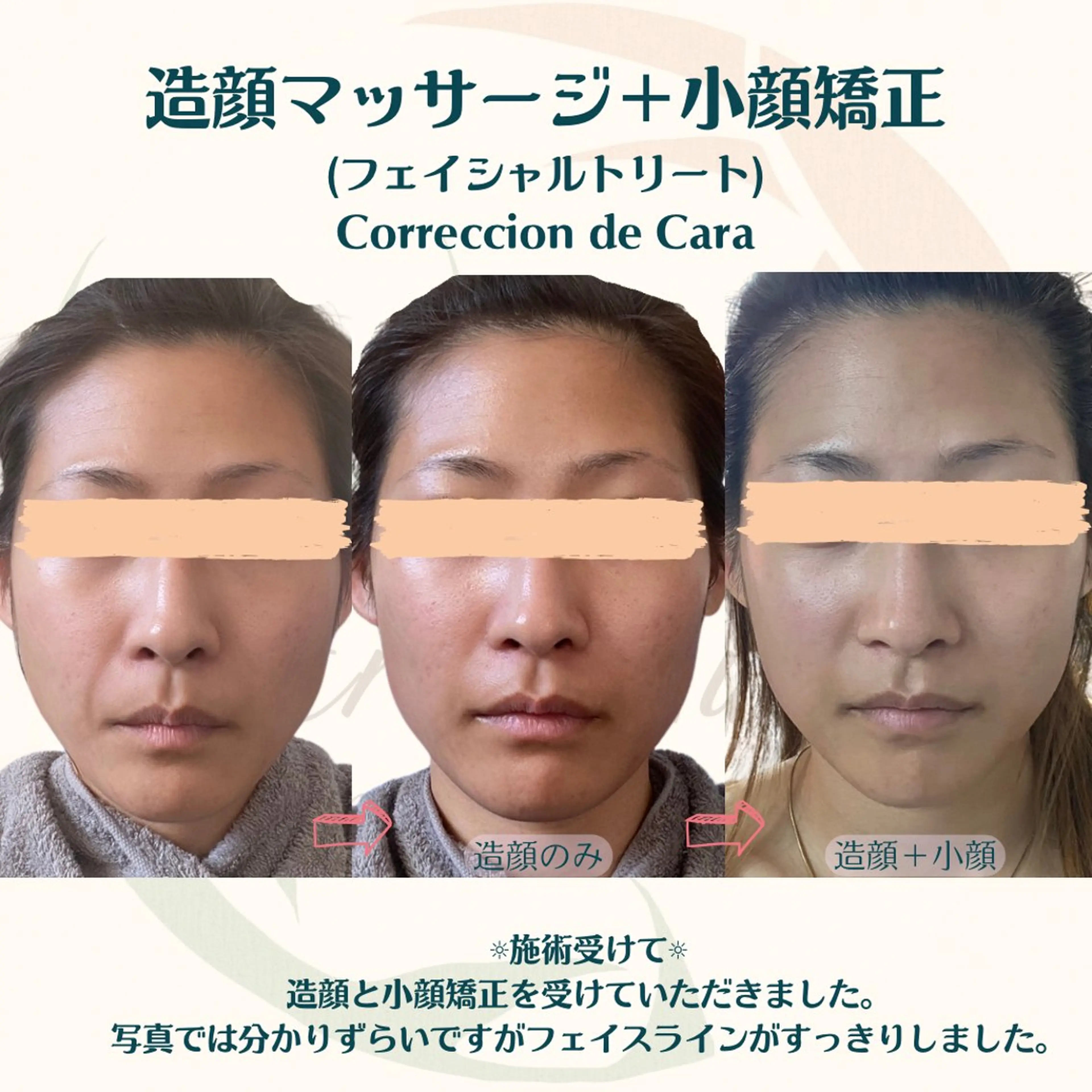 小顔矯正☀︎バスト ☀︎ハルのエステ・リラクイメージ