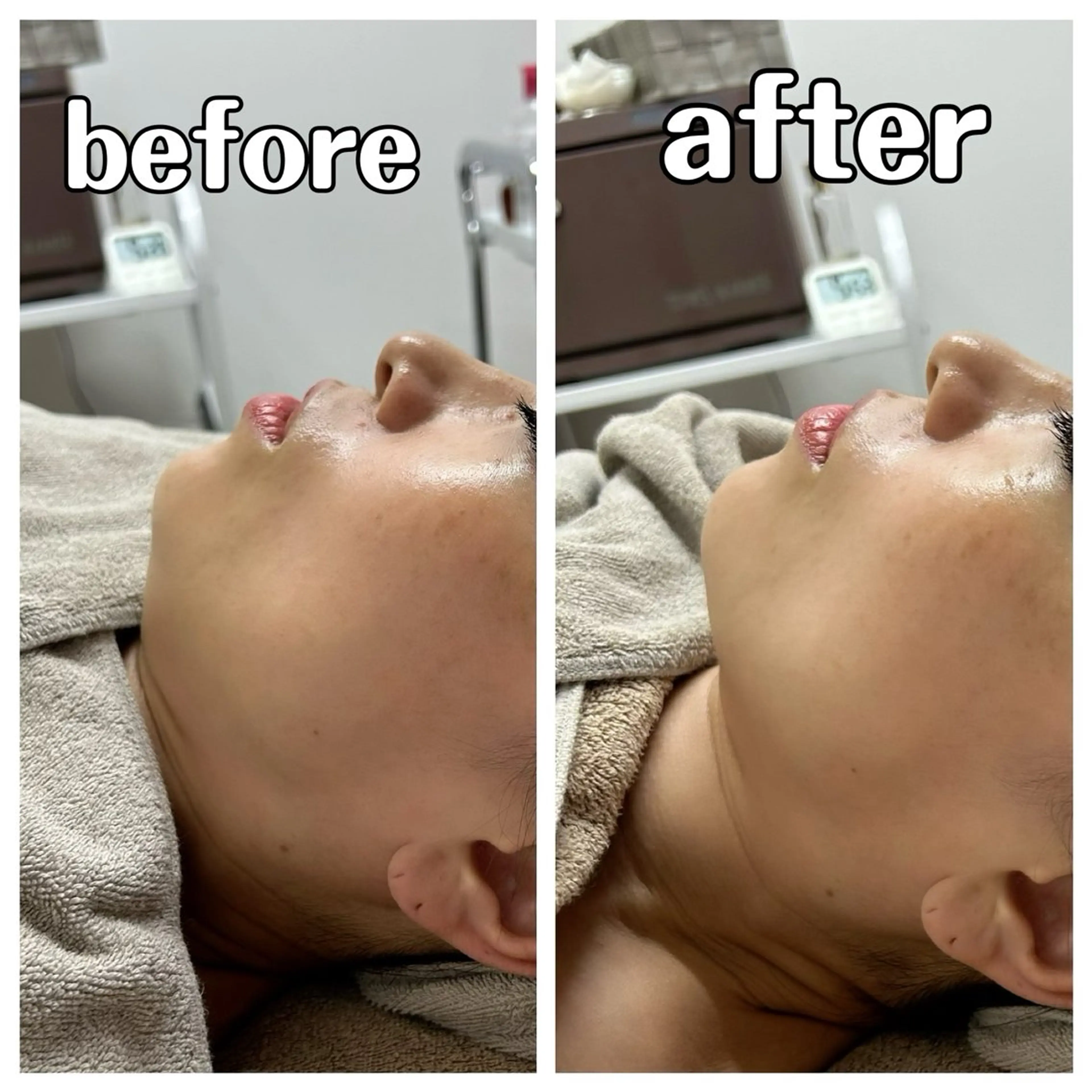 コアラル恵比寿店 chiakiのエステ・リラクイメージ