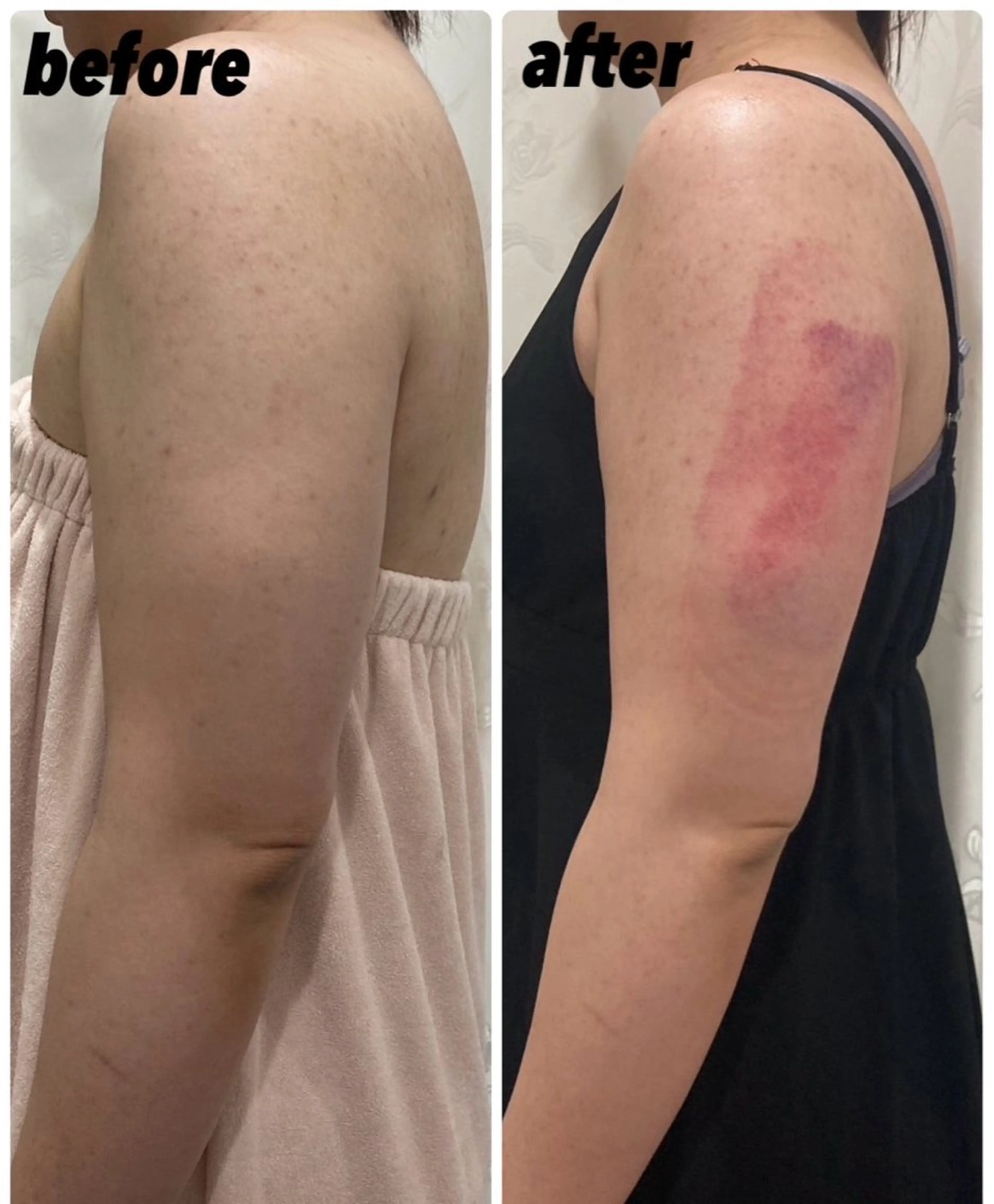 秒速小顔所属・秒速小顔 岩邊のその他イメージ