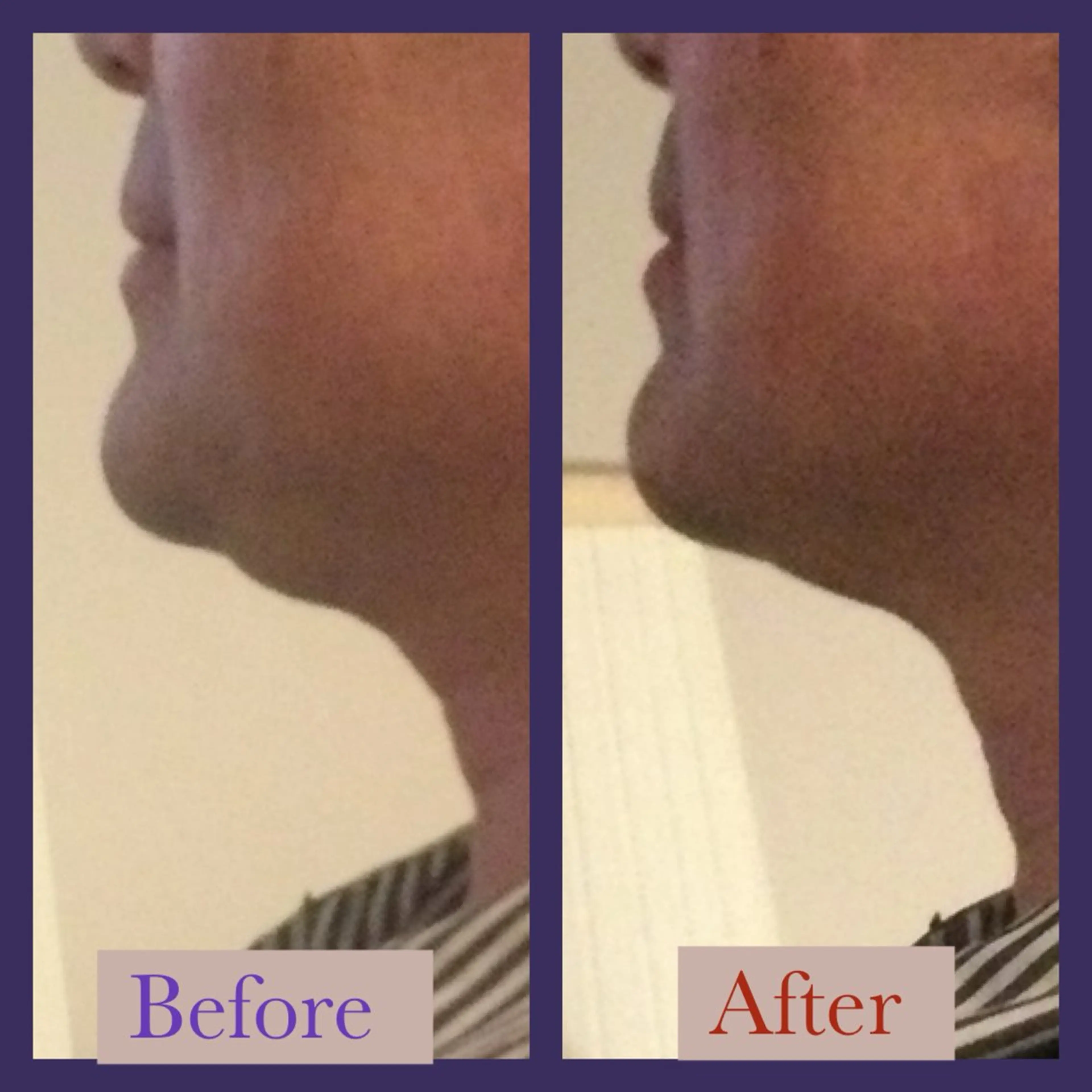 エステ ﾌﾟﾗｲﾍﾞｰﾄｻﾛﾝ アンクチュール所属・UnCouture 〜アンクチュール〜のエステ・リラクイメージ