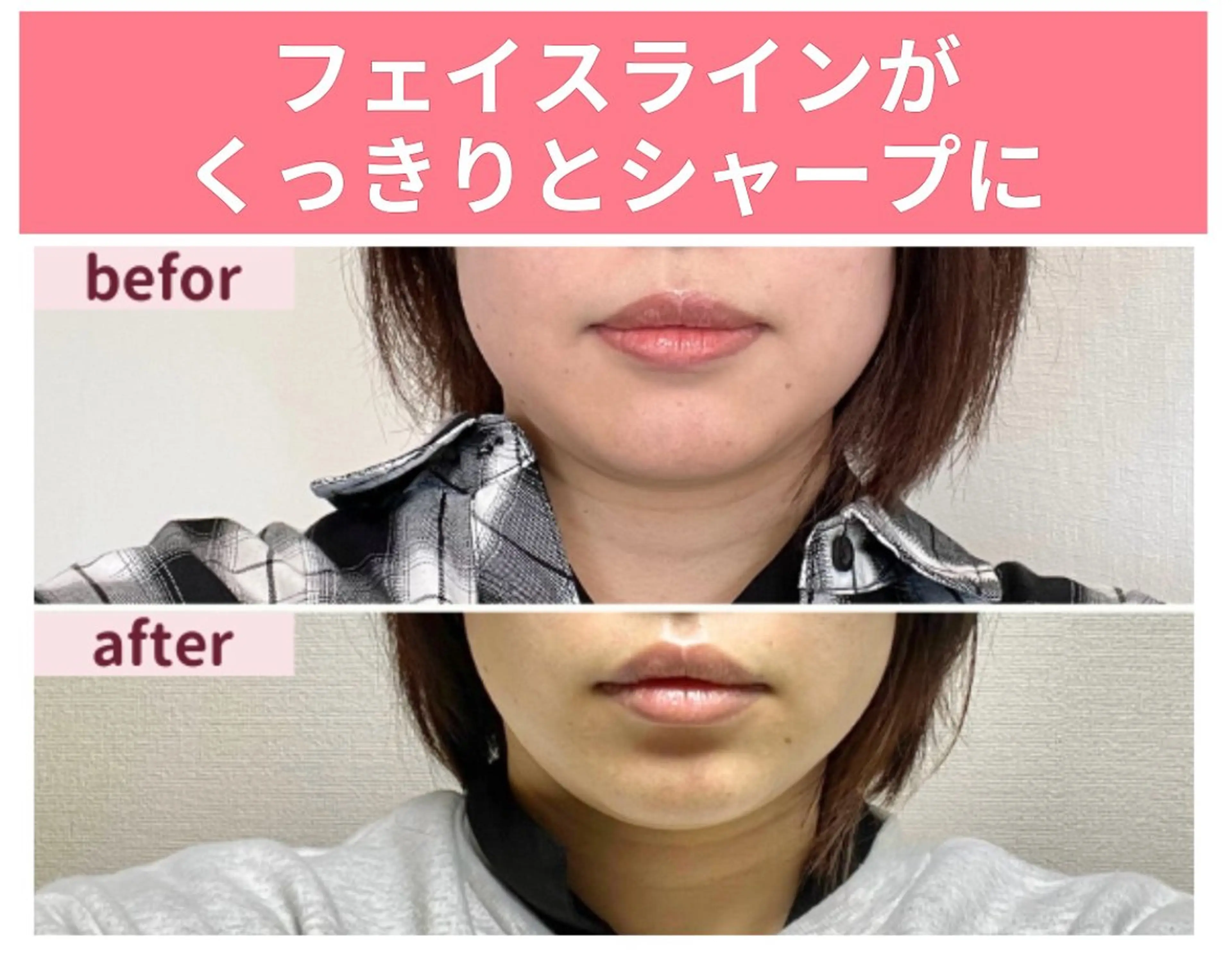 小顔になるだけじゃない💆‍♀️『お悩み改善小顔矯正マッサージ』」初回 🔰‪✨️の写真