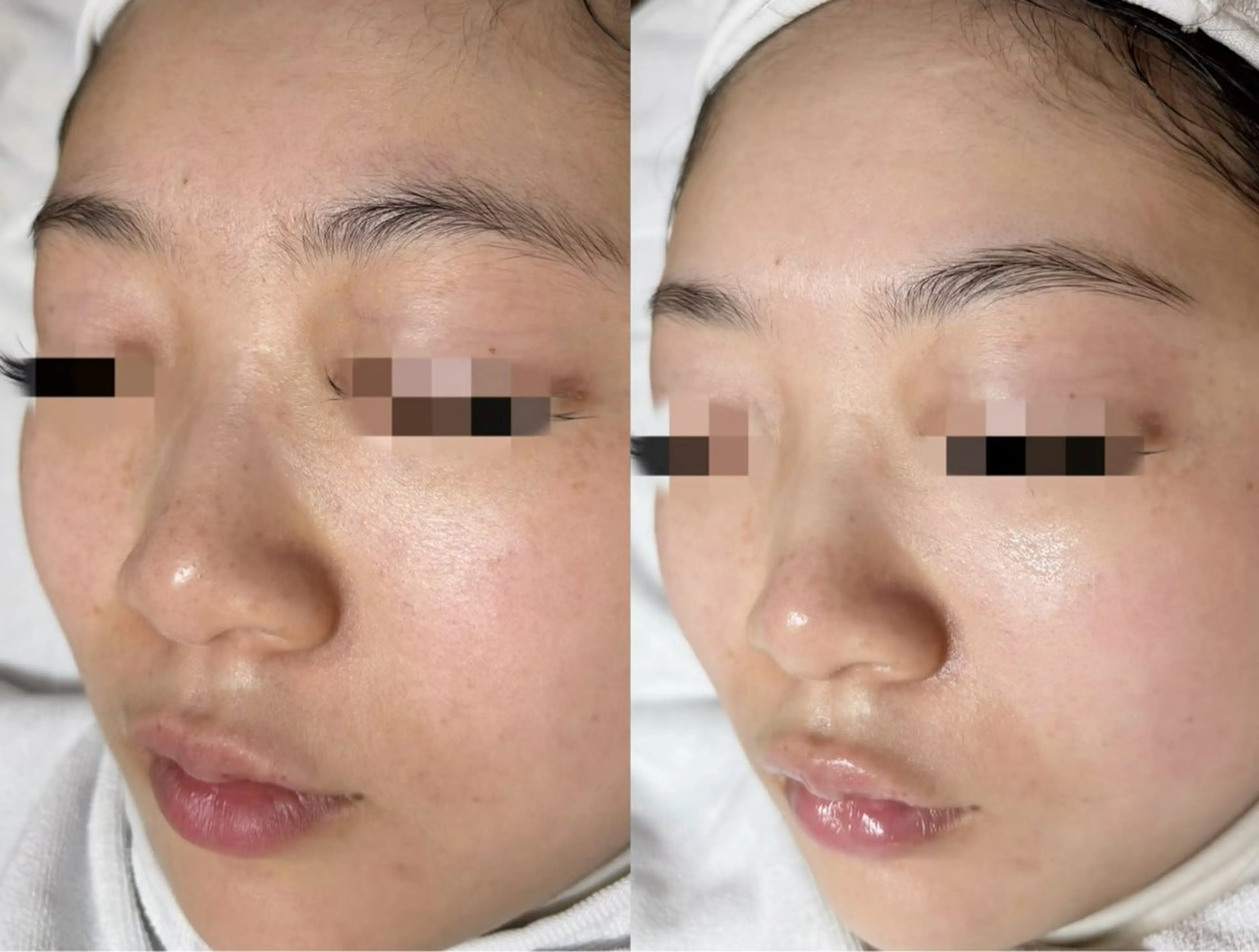 MONICAビューティサロン所属・MONICAサロン ⭐︎フェイシャル痩身のエステ・リラクイメージ