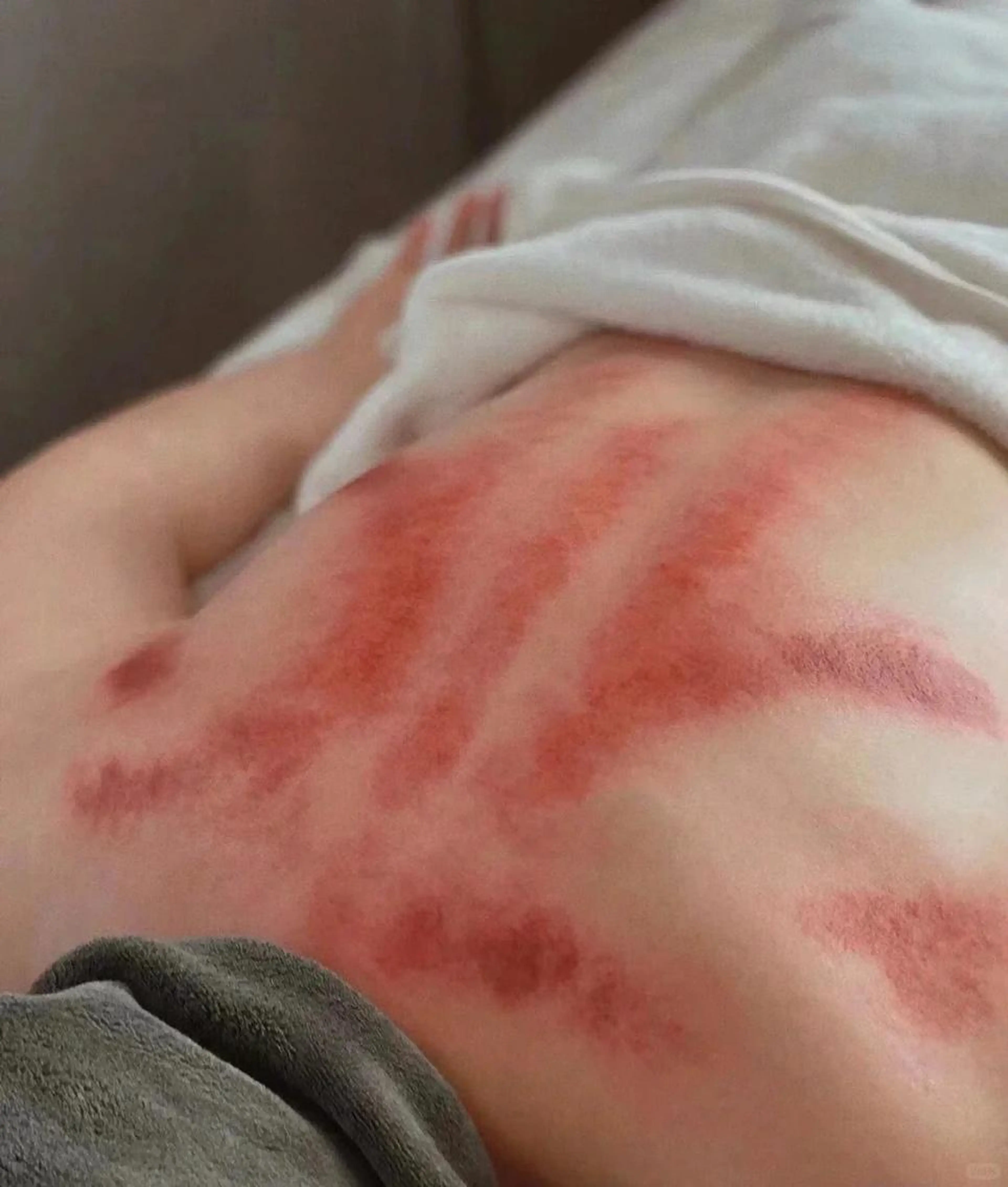 【★血行促進にアプローチ★】　アロマオイル60分＋かっさorカッピング20分の写真