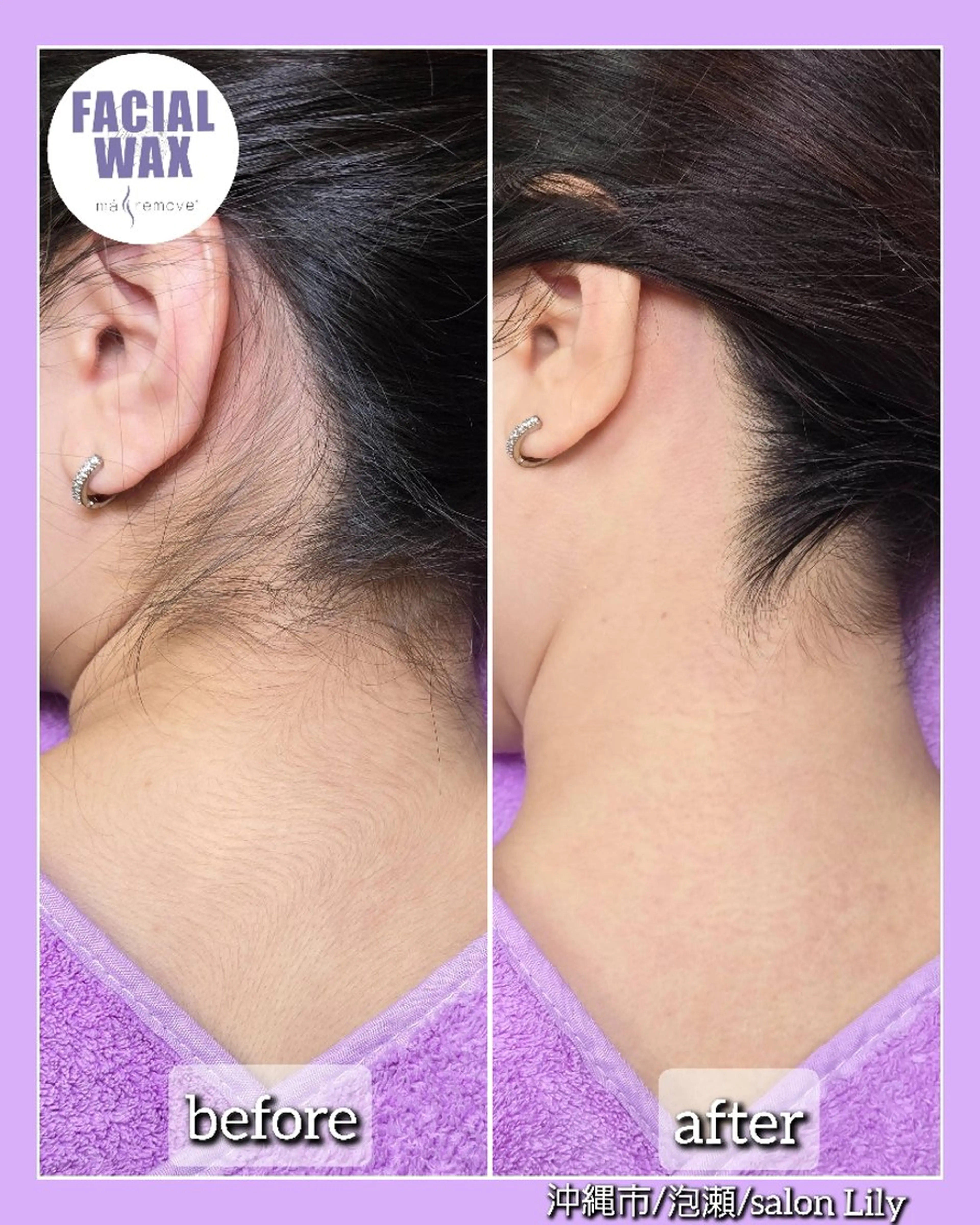 脱毛 facial salon Lily所属・salon Lilyのエステ・リラクイメージ