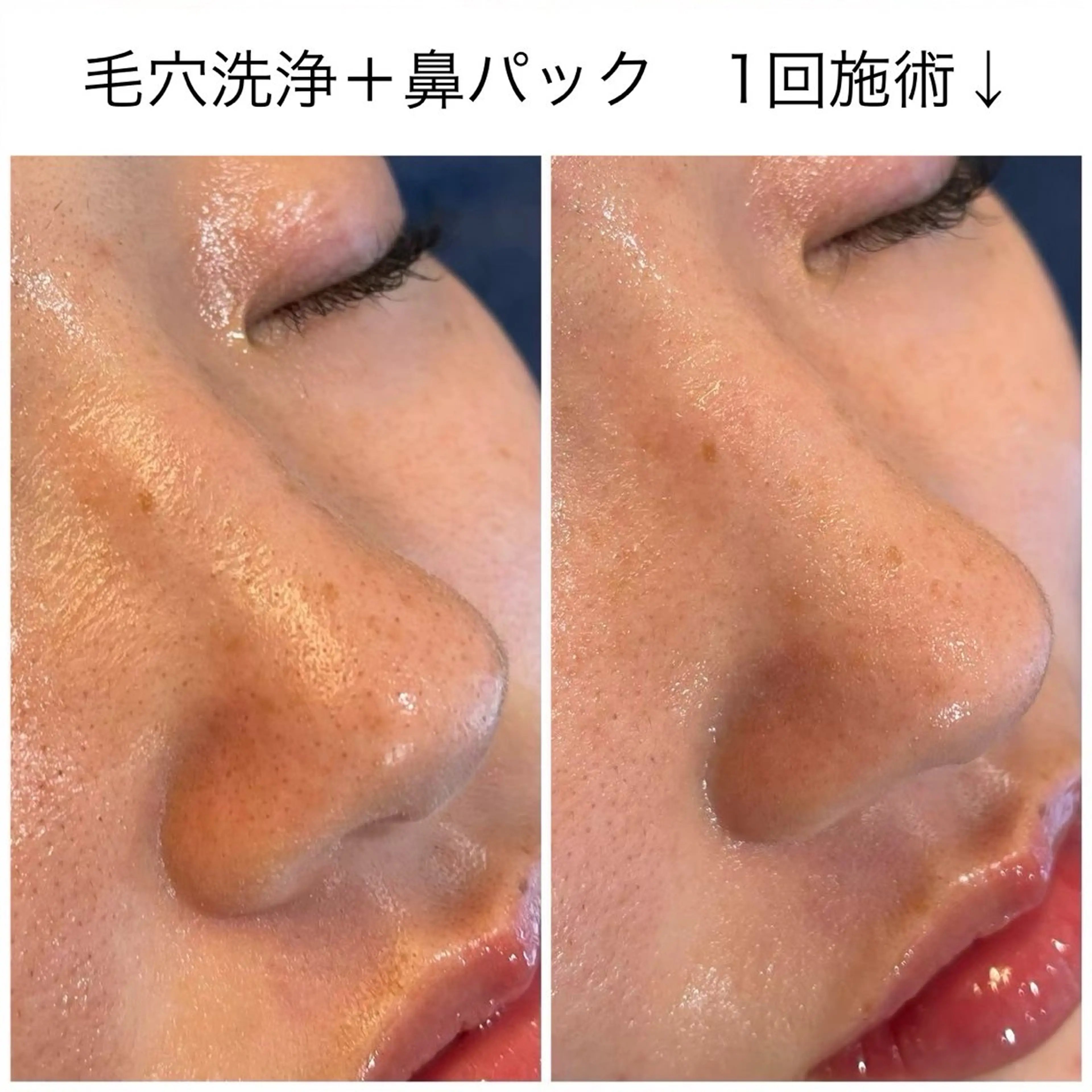 leolo武蔵浦和 肌質改善&脱毛のエステ・リラクイメージ