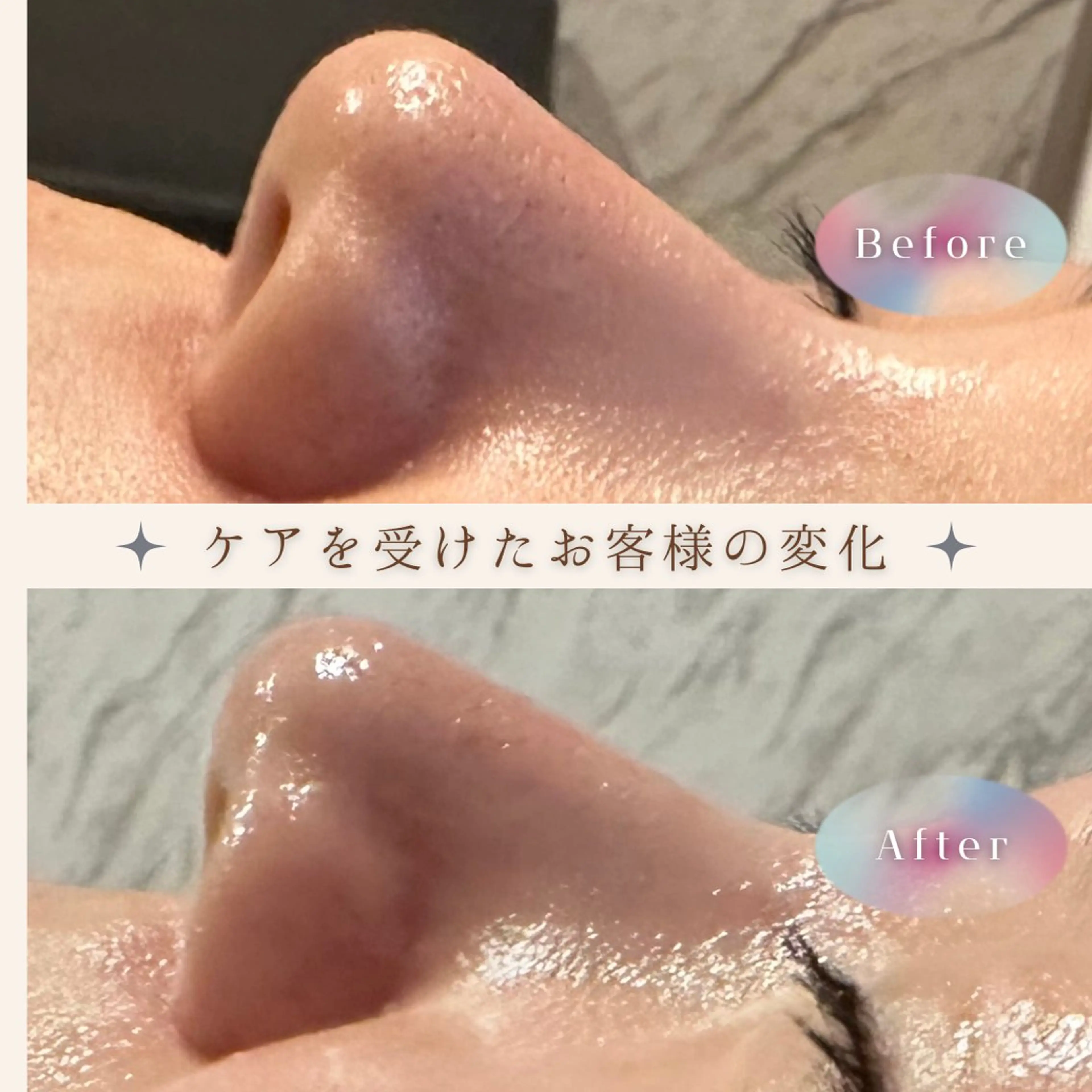 【顔のザラつき・くすみ】や【鼻の黒ずみ・毛穴】などフェイシャルケアの写真