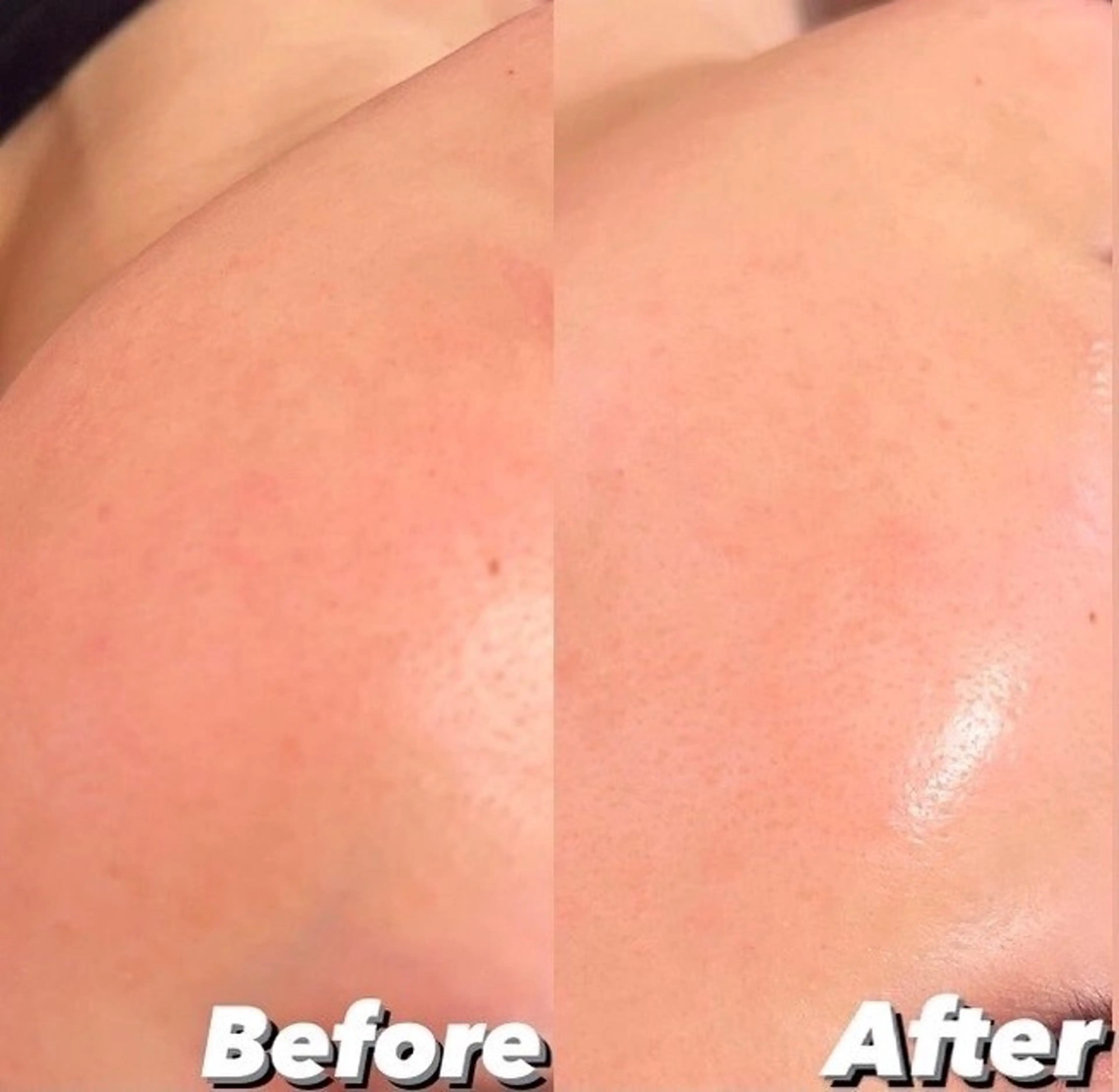 エステ アイラッシュ&エステサロンLinda西宮所属・小顔&毛穴・肌質改善 LINDA西宮 AIのエステ・リラクイメージ